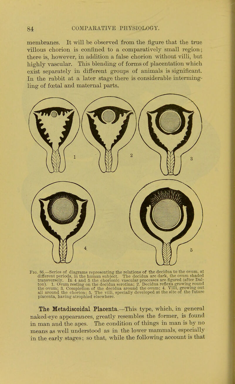 membranes. It will be observed from tbe figure that the tnie villous chorion is confined to a comparatively small region; there is, however, in addition a false chorion without villi, but highly vascular. This blending of forms of placentation which exist separately in different groups of animals is significant. In the rabbit at a later stage there is considerable interming- ling of foetal and maternal parts. Fig. 86.—Series of diagrams representing the relations of the decidua to the ovum, at different periods, in the human subject. The decidua are darli, the ovnm shaded transversely. In 4 and 5 the chorionic vascular processes are figured (after Dal- ton). 1. Ovum resting on the decidua serotina; 2. Decidua reflexa growing round the ovum; 3. Completion of the decidua around the ovum; 4. Villi, growing out all around the chorion; 5. The villi, specially developed at the site of the future placenta, having atrophied elsewhere. The Metadiscoidal Placenta.—This type, which, in general naked-eye appearances, greatly resembles the former, is found in man and the apes. The condition of things in man is by no means as well understood as in the lower mammals, especially in the early stages; so that, while the following account is that