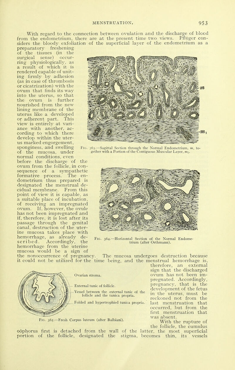 363.—Sagittal Section through the Normal Endometrium, m, to- gether with a Portion of the Contiguous Muscular Layer, mi. With regard to the connection between ovulation and the discharge of blood from the endometrium, there are at the present time two views. Pfliiger con- siders the bloody exfoliation of the superficial layer of the endometrium as a preparatory freshening of the tissues (in the surgical sense) occur- ring physiologically, as a result of which it is rendered capable of unit- ing firmly by adhesion (as in case of thrombosis or cicatrization) with the ovum that finds its way into the uterus, so that the ovum is further nourished from the new lining membrane of the uterus like a developed or adherent part. This view is entirely at vari- ance with another, ac- cording to which there develop within the uter- us marked engorgement, sponginess, and swelling Fig. of the mucosa, under normal conditions, even before the discharge of the ovum from the follicle, in con- sequence of a sympathetic formative process. The en- dometrium thus prepared is designated the menstrual de- cidual membrane. From this point of view it is capable, as a suitable place of incubation, of receiving an impregnated ovum. If, however, the ovule has not been impregnated and if, therefore, it is lost after its passage through the genital canal, destruction of the uter- ine mucosa takes place with hemorrhage, as already de- scribed. Accordingly, the hemorrhage from the uterine mucosa would be a sign of the nonoccurrence of pregnancy. The mucosa tmdergoes destruction because it could not be utilized for the time being, and the menstrual hemorrhage is, therefore, an external sign that the discharged ovum has not been im- pregnated. Accordingly, pregnancy, that is the development of the fetus in the uterus, must be reckoned not from the last menstruation that occurred, but from the first menstruation that was absent. With the rupture of the follicle, the cumulus oophorus first is detached from the wall of the latter, the most superficial portion of the follicle, designated the stigma, becomes thin, its vessels Fio. 364.- -Horizontal Section of the Normal Endome- trium (after Orthmann). Ovarian stroma. External tunic of folhcle. -Vessel between the external tunic of the follicle and the tunica propria. Folded and hypertrophied tunica propria. Fresh Corpus luteum (after Balbiani).