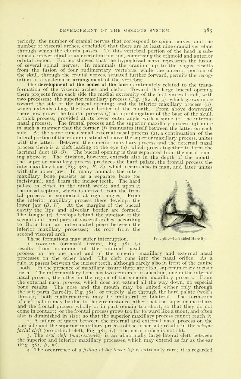 DEVELOPMENT OF THE OSSEOUS SYSTEM. teriorly, the number of cranial nerves that correspond to spinal nerves, and the number of visceral arches, concluded that there are at least nine cranial vertebrae through which the chorda passes. To this vertebral portion of the head is sub- joined a prevertebral or an evertebral portion, comprising the ethmoid and anterior orbital region. Froriep showed that the hypoglossal nerve represents the fusion of several spinal nerves. In mammals the cranium up to the vagus results from the fusion of four rudimentary vertebrae, while the anterior portion of the skull, through the cranial nerves, situated further forward, permits the recog- nition of a systematic arrangement of the vertebrse. The development of the bones of the face is intimately related to the trans- formation of the visceral arches and clefts. Toward the large buccal opening there projects from each side the medial extremity of the first visceral arch, with two processes: the superior maxillary process (Fig. 382, A, 3), which grows more toward the side of the buccal opening: and the inferior maxillarv process (u), which extends along the lower border of the mouth. From above downward there now grows the frontal process (/) as a prolongation of the base of the skull, a thick process, provided at its lower outer angle with a spine (i, the internal nasal process). The frontal process and the superior maxillary process (3) unite in such a manner that the former (/) insinuates itself between the latter on each side. At the same time a small external nasal process (2), a continuation of the lateral portion of the cranium, situated above the superior maxillary process, unites with the latter. Between the superior maxillary process and the external nasal process there is a cleft leading to the eye (a), which grows together to form the lacrimal duct (B, O). The buccal opening is thus separated from the nasal open- ing above it. The division, however, extends also in the depth of the mouth; the superior maxillary process produces the hard palate, the frontal process the intermaxillary bone (Fig. 382, B, Z), which occurs also in man, and later unites with the upper jaw. In many animals the inter- maxillary bone persists as a separate bone (os incisivum), and bears the incisor teeth. The hard ;s ■'^is palate is closed in the ninth week; and upon it the nasal septum, which is derived from the fron- tal process, is supported at right angles. From the inferior maxillary process there develops the lower jaw (B, U). At the margins of the buccal cavity the lips and alveolar border are formed. The tongue (s) develops behind the junction of the second and third pairs of visceral arches, according to Bom from an intercalated piece between the inferior maxillary processes; its root from the second visceral arch. These formations may suffer interruption. Fig. 381.—Left-sided Hare-lip. 1. Hare-lip (oronasal fissure, Fig. 382, C) results from nonunion of the internal nasal process on the one hand and of the superior maxillary and external nasal processes on the other hand. The cleft runs into the nasal orifice. As a rule, it passes between the incisor teeth, although rarely also in front of the canine tooth. In the presence of maxillary fissure there are often supernumerary incisor teeth. The intermaxillary bone has two centers of ossification, one in the internal nasal process, the other in the region of the superior maxillary process. From the external nasal process, which does not extend all the way down, no especial bone results. The nose and the mouth may be united either only through the soft parts (hare-lip. Fig. 381), or entirely, also through the hard palate (wolf's throat); both malformations may be unilateral or bilateral. The formation of cleft palate may be due to the circumstance either that the superior maxillary and the frontal process wholly or in part remain too short, so that they do not come in contact; or the frontal process grows too far forward like a snout, and often also is diminished in size; so that the superior maxillary process cannot reach it. 2. A failure of union between the internal and external nasal process on the one side and the superior maxillary process of the other' side results in the oblique facial cleft (oro-orbital cleft. Fig. 382, D); the nasal orifice is not slit. 3. The oral cleft [macrostomia) is an abnormally large lateral cleft between the superior and inferior maxillary processes, which may extend as far as the ear (Fig. 382, B, m). 4. The occurrence of a fistula of the lower lip is extremely rare; it is regarded