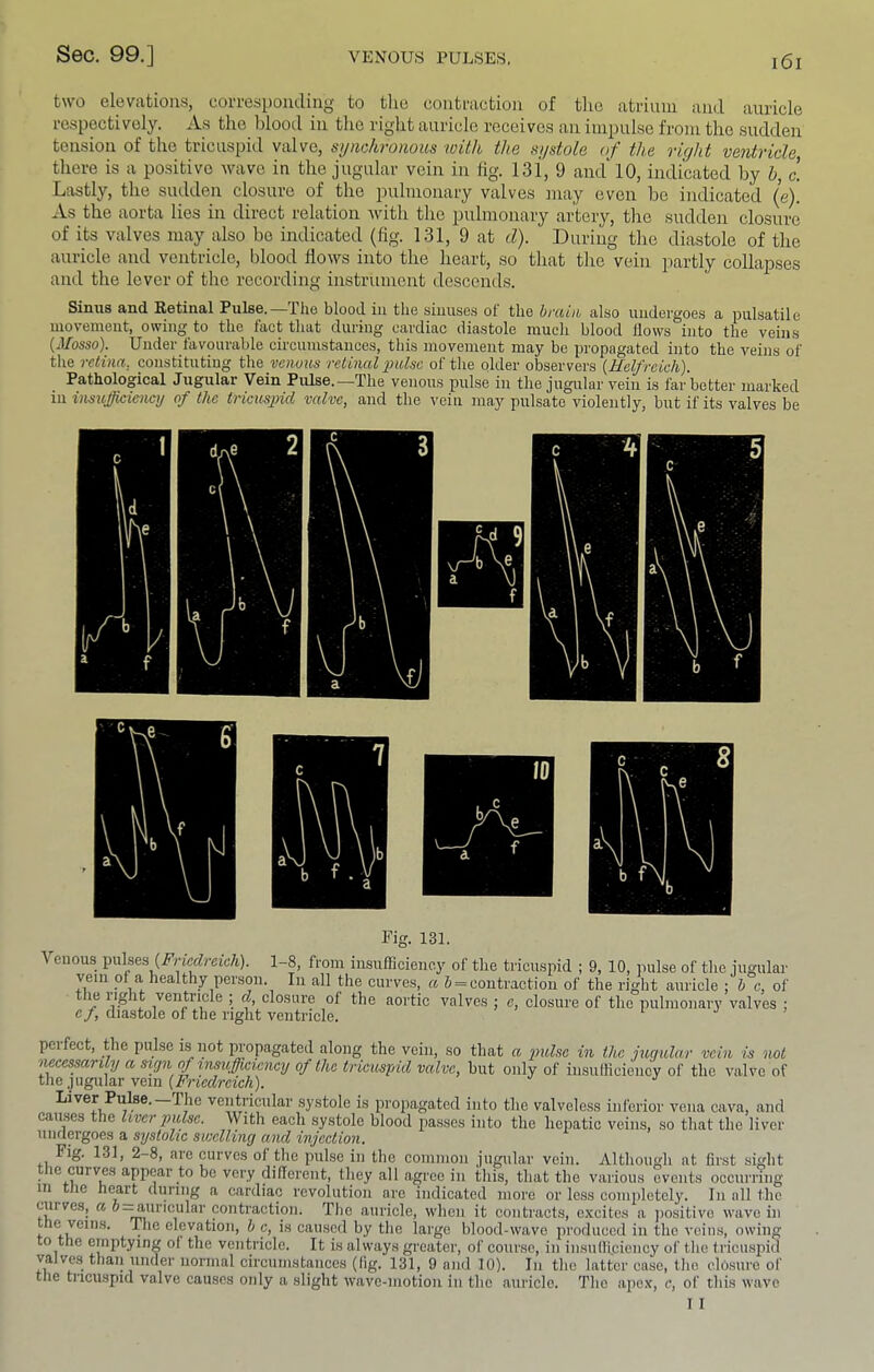two elevations, corresponding to tlie contraction of tlie atrium and auricle respectively. As the blood in the right auricle receives an impulse from the sudden tension of the tricuspid valve, symhronous with the systole of the right ventricle tliere is a positive wave in the jugular vein in fig. 131, 9 and 10, indicated Ijy h, L Lastly, the sudden closure of the pulmonary valves may even be indicated (e). As the aorta lies in direct relation with tlie pulmonary artery, the sudden closure of its valves may also be indicated (fig. 131, 9 at d). During the diastole of the auricle and ventricle, blood flows into the heart, so that tlie vein partly collapses and tlie lever of the recording instrument descends. Sinus and Retinal Pulse. Iho blood iii the sinuses of the hrciin also undergoes a pulsatile movement, owing to the fact that during cardiac diastole much blood flows into the veins {Mosso). Under favourable circumstances, this movement may be propagated into the veins of the retina, constituting the yejious retinal f alse of the older observers {Halfrcich). Pathological Jugular Vein Pulse.—The venous pulse in the jugular vein is far better marked in insufficiency of the tricusjhd valve, and the vein may pulsate violently, but if its valves be Fig. 131. Venous pulses 1-8, from insufficiency of the tricuspid ; 9, 10, pulse of the jugular vein of a healthy person. In all the curves, a 6 = contraction of the right auricle ; h c, of le light ventricle ; d, closure of the aortic valves ; e, closure of the pulmonary valves : e/, diastole of the right ventricle. pci feet, the pulse is not propagated along the vein, so that a fulse in the mgular vein is not necessarily a saejn of xnmfficicncy of the tricuspid valve, but only of insufliciency of the valve of tlie jugular vein (Friedreich). Liver Pulse. The ventricular systole is propagated into the valveless inferior vena cava, and causes the liver pulse. With each systole blood passes into the hepatic veins, so that the liver undergoes a systolic swelling and injection. Fig. 131, 2-8, are curves of the pulse in the common jugular vein. Although at first sight le curves appear to be very difierciit, they all agree in this, that the various events occurring III the heart during a cardiac revolution are indicated more or less completely. In all the cuiveSj a o^uricular contraction. The auricle, when it contracts, e.vcites a jiositive wave in he veins. The elevation, h c, is caused by the large blood-wave produced in the veins, owing to the emptying of the ventricle. It is always greater, of course, in insufiiciency of the tricuspid valves than under normal circumstpees (fig. 131, 9 and 10). In the latter case, the closure of the tricuspid valve causes only a slight wave-motion in the auricle. The iijicx, c, of this wave