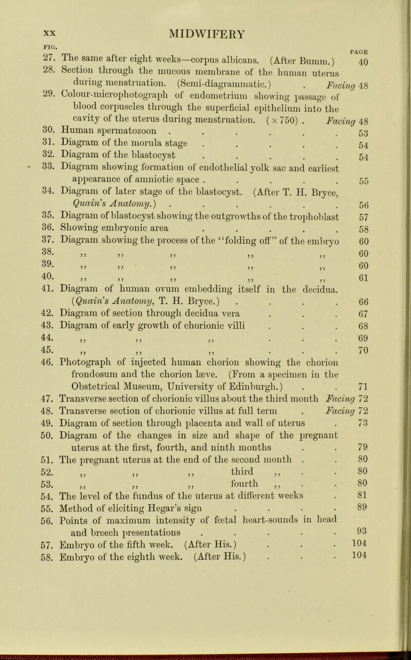 FIG. 27. 28. 29. 30. 31. 32. 33. 34. 35. 36. 37. 38. 39. 40. 41. 42. 43. 44. 45. 46. 47. 48. 49. 50. 51. 52. 53. 54. 55. 56. 57. 58. . PAGE ine same after eight weeks—corpus albicans. (After Bumm.) 40 Section through the mucous membrane of the human uterus during menstruation. (Semi-diagrammatic.) . Facing 48 Colour-microphotograph of endometrium showing passage of blood corpuscles through the superficial epithelium into the cavity of the uterus during menstruation. ( x 750) . Facing 48 Human spermatozoon ..... Diagram of the morula stage ..... Diagram of the blastocyst ..... Diagram showing formation of endothelial yolk sac and earliest appearance of amniotic space ..... Diagram of later stage of the blastocyst. (After T. H. Bryce, Quain’s Anatomy.) . Diagram of blastocyst showing the outgrowths of the trophoblast Showing embryonic area ..... Diagram showing the process of the “folding off” of the embryo 53 54 54 3 3 3 3 3 3 3 3 3 3 3 3 3 3 3 3 3 3 3 3 Diagram of human ovum embedding itself in the decidua (Quain's Anatomy, T. H. Bryce.) Diagram of section through decidua vera Diagram of early growth of chorionic villi 56 57 58 60 60 60 61 66 67 68 69 70 Photograph of injected human chorion showing the chorion frondosum and the chorion lseve. (From a specimen in the Obstetrical Museum, University of Edinburgh.) . . 71 Transverse section of chorionic villus about the third month Facing 72 Transverse section of chorionic villus at full term . Facing 72 Diagram of section through placenta and wall of uterus Diagram of the changes in size and shape of the pregnant uterus at the first, fourth, and ninth months The pregnant uterus at the end of the second month . ,, ,, ,, third ,, ,, ,, fourth ,, The level of the fundus of the uterus at different weeks Method of eliciting Hegar’s sign Points of maximum intensity of foetal heart-sounds in head and breech presentations .... Embryo of the fifth week. (After His.) Embryo of the eighth week. (After His.) 73 79 80 80 80 81 89 93 104 104