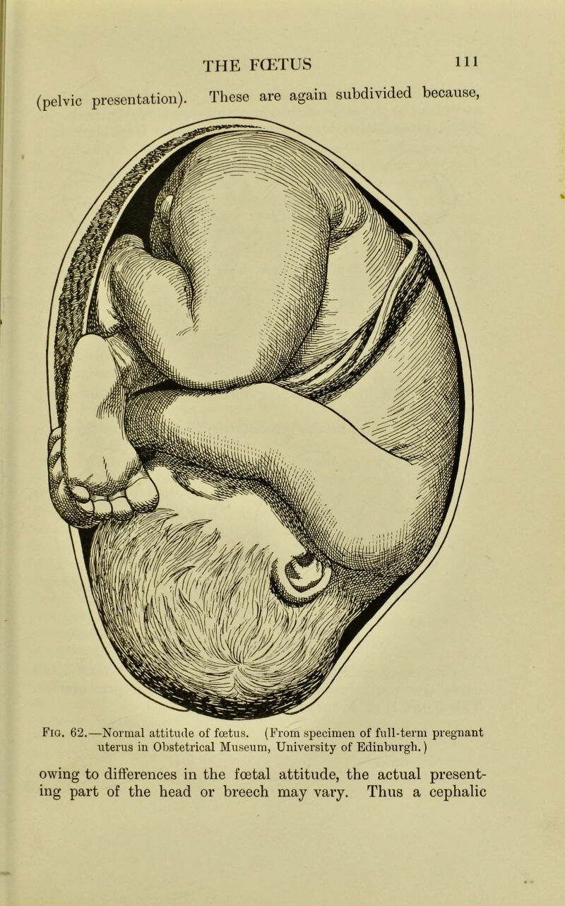 (pelvic presentation). These are again subdivided because: Fig. 62.—Normal attitude of foetus. (From specimen of full-term pregnant uterus in Obstetrical Museum, University of Edinburgh.) owing to differences in the foetal attitude, the actual present- ing part of the head or breech may vary. Thus a cephalic