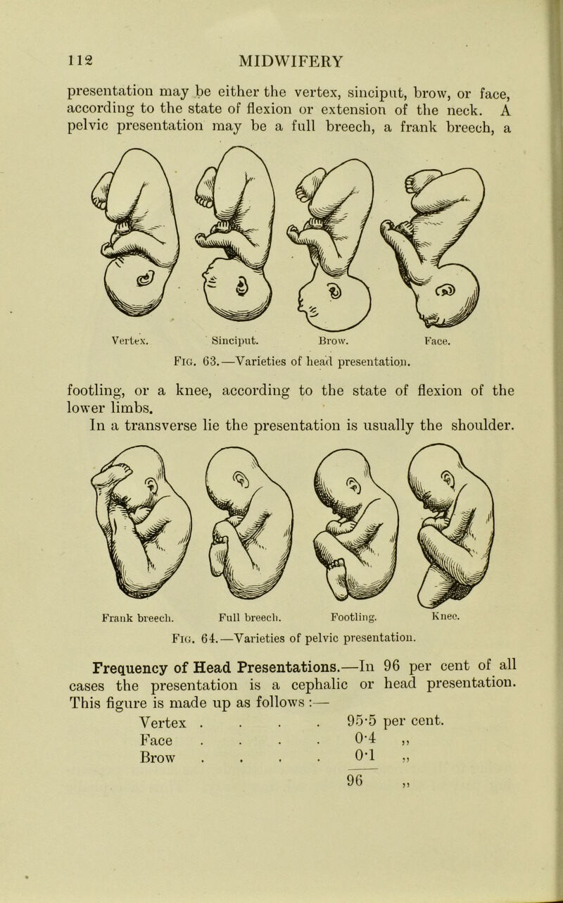 presentation may be either the vertex, sinciput, brow, or face, according to the state of flexion or extension of the neck. A pelvic presentation may be a full breech, a frank breech, a Vertex. Sinciput. Brow. Face. Fig. 63.—Varieties of head presentation. footling, or a knee, according to the state of flexion of the lower limbs. In a transverse lie the presentation is usually the shoulder. Fig. 64.—Varieties of pelvic presentation. Frequency of Head Presentations.—In cases the presentation is a cephalic or This figure is made up as follows :— Vertex .... 95-5 per cent. Face .... 0-4 Brow .... 0T 96 per cent of all head presentation. 5) 96