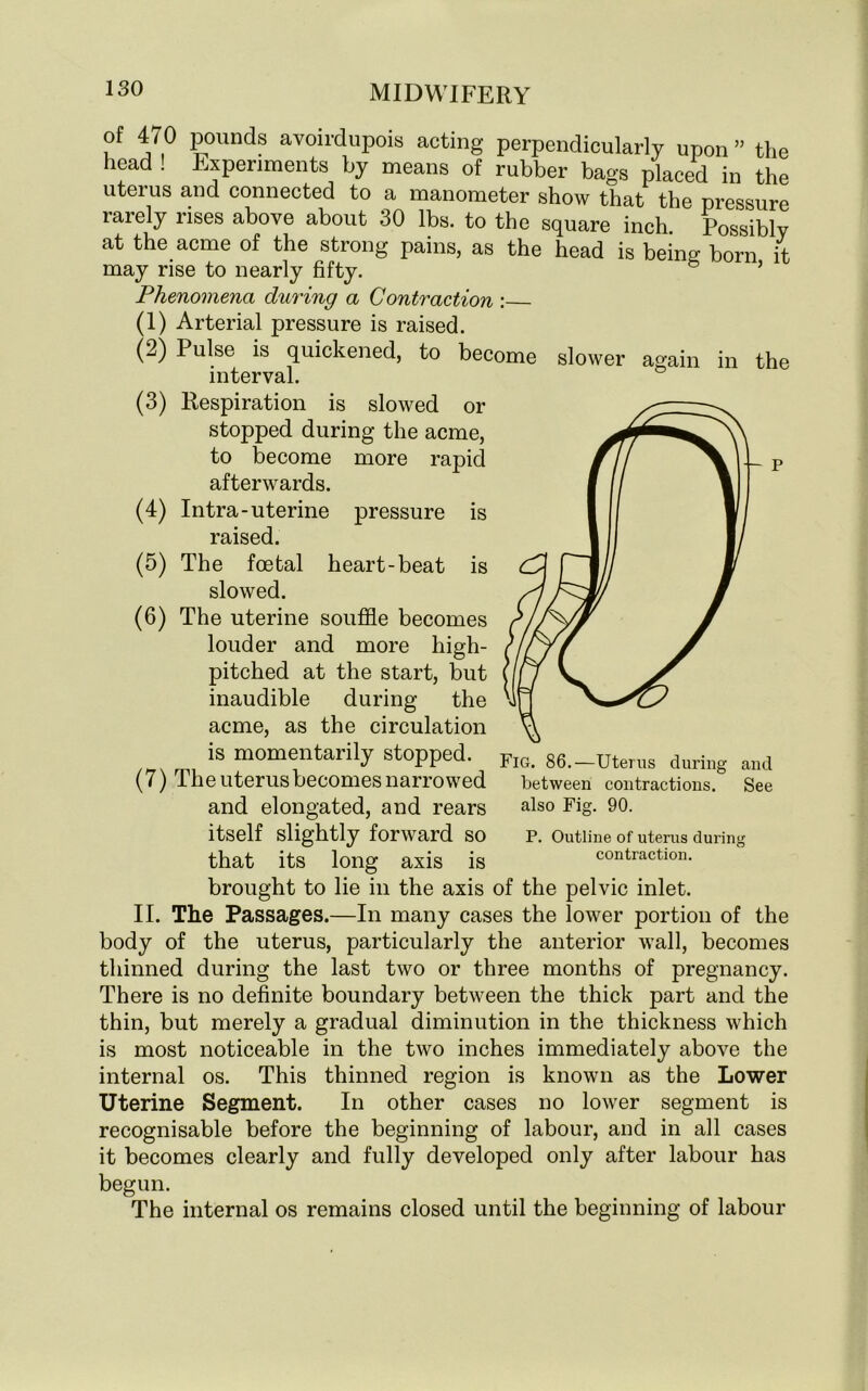 of 470 pounds avoirdupois acting perpendicularly upon ” the head ! Experiments by means of rubber bags placed in the uterus and connected to a manometer show that the pressure rarely rises above about 30 lbs. to the square inch Possibly at the acme of the strong pains, as the head is being born it may rise to nearly fifty. ’ Phenomena during a Contraction : (1) Arterial pressure is raised. (2) Pulse is quickened, to become slower again in the interval. (3) Respiration is slowed or stopped during the acme, to become more rapid afterwards. (4) Intra-uterine pressure is raised. (5) The foetal heart-beat is slowed. (6) The uterine souffle becomes louder and more high- pitched at the start, but inaudible during the acme, as the circulation is momentarily stopped. (7) The uterus becomes narrowed and elongated, and rears itself slightly forward so that its long axis is brought to lie in the axis of the pelvic inlet. II. The Passages.—In many cases the lower portion of the body of the uterus, particularly the anterior wall, becomes thinned during the last two or three months of pregnancy. There is no definite boundary between the thick part and the thin, but merely a gradual diminution in the thickness which is most noticeable in the two inches immediately above the internal os. This thinned region is known as the Lower Uterine Segment. In other cases no lower segment is recognisable before the beginning of labour, and in all cases it becomes clearly and fully developed only after labour has begun. The internal os remains closed until the beginning of labour Fig. 86.—Uterus during and between contractions. See also Fig. 90. P. Outline of uterus during contraction.