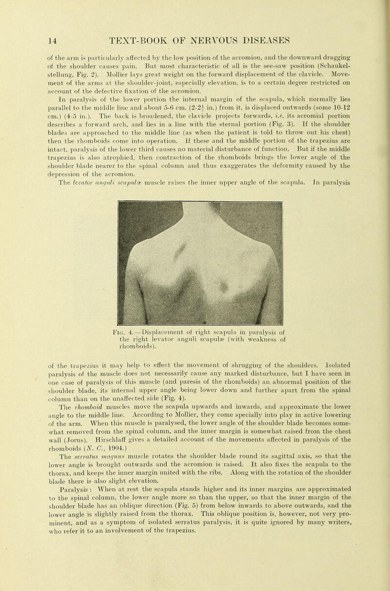 of the arm is particulaily affected by the low position of the acromion, and the downward dragging of the shoulder causes pain. But most characteristic of all is the see-saw jiosition (Schaukel- stellimg. Fig. 2). iloUier lays great weight on the forward displacement of the clavicle. Move- ment of the arms at the shoulder-joint, especially elevation, is to a cei-tain degree restricted on account of the defective fixation of the acromion. In paralysis of tlie lower portion the internal margin of the scapula, which normally lies parallel to the middle line and about 5-fi cm. (2-21 in.) from it, is displaced outwards (some 10-12 cm.) (4-5 in.). The back is broadened, the clavicle projects forwards, i.e. its acromial portion describes a forward arch, and lies in a line with the sternal portion (Fig. 3). If the shoulder blades are approached to the middle line (as when the patient is told to throw out his chest) then the rhomboids come into operation. If these and the middle portion of the trapezius are intact, paralysis of the lower third causes no material disturbance of function. But if the middle trapezius is also atrophied, then contraction of the rhomboids brings the lower angle of the shoulder blade nearer to the spinal column and thus exaggerates the deformitj' caused by the depression of the acromion. The levator angtdi sca-puloe muscle raises the inner upper angle of the scapula. In paralysis Fig. 4.—Displacement of right scapula in paralysis of the right levator anguli scapulae (with weakness of rhomboids). of the trapezius it may help to effect the movement of shrugging of the shoulders. Isolated paralysis of the muscle does not necessarily cause any marked disturbance, but I have seen in one case of paralysis of this muscle (and paresis of the rhomboids) an abnormal position of the shoulder blade, its internal upper angle being lower down and further apart from the spinal column than on the unaffected side (Fig. 4). The rhomboid muscles move the scapula upwards and inwards, and approximate the lower angle to the middle line. According to MoUier, they come speciaUj' into play in active lowering of the arm. When this muscle is paralysed, the lower angle of the shoulder blade becomes some- what removed from the spinal column, and the inner margin is somewhat raised from the chest wall (Jorns). Hirschlaff gives a detailed account of the movements affected in paralysis of the rhomboids (N. C, 1904.) The serratus marjnus muscle rotates the shoulder blade round its sagittal axis, so that the lower angle is brought outwards and the acromion is raised. It also fixes the scapula to the thorax, and keeps the inner margin united with the ribs. Along with the rotation of the shoulder blade there is also slight elevation. Paralysis : When at rest the scapula stands higher and its mner margins are ajiproximated to the spinal column, the lower angle more so than the upper, so that the inner margin of the shoulder blade has an oblique direction (Fig. 5) from below inwards to above outwards, and the lower angle is slightly raised from the thorax. This oblique position is, however, not very pro- minent, and as a symptom of isolated serratus paralysis, it is quite ignored by many wTiters, who refer it to an involvement of the trapezius.