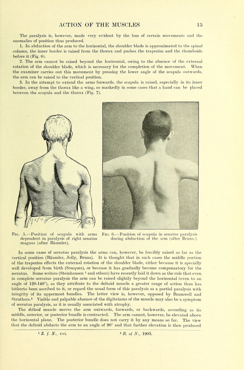 The paralysis is, however, made very evident by the loss of cei'tain movements and the anomalies of position thus produced. 1. In abduction of the arm to the horizontal, the shoulder blade is approximated to the spinal column, the inner border is raised from the thorax and pushes the trapezius and the rhomboids before it (Fig. 6). 2. The arm cannot be raised beyond the horizontal, owing to the absence of the external rotation of the shoulder blade, which is necessary for the completion of the movement. When the examiner carries out this movement by pressing the lower angle of the scapula outwards, the arm can be raised to the vertical position. 3. In the attempt to extend the arms forwards, the scapula is raised, especially in its uiner border, away from the thorax like a wing, so markedly in some cases that a hand can be placed between the scapula and the thorax (Fig. 7). Fig. 5.—Position of scapula with arms Fig. 6.—Position of scapula in senatus paralysis dependent in paralysis of right senatus during abduction of the arm (after Bruns.) magnus (after Baumler). In some cases of serratus paralysis the arms can, however, be forcibly raised as far as the vertical position (Baumler, Jolly, Bruns). It is thought that in such cases the middle portion of the trapeziiis effects the external rotation of the shoulder blade, either because it is specially well developed from birth (Souques), or because it has gradually become compensatory for the serratus. Some writers (Steinhausen ^ and others) have recently laid it down as the rule that even in complete serratus paralysis the arm can be raised slightly beyond the horizontal (even to an angle of 120-140°), as they attribute to the deltoid muscle a greater range of action than has hitherto been ascribed to it, or regard the usual form of this paralysis as a partial paralysis with integrity of its uppermost bundles. The latter view is, however, opposed by Bramwell and Struthers.2 Visible and palpable absence of the digitations of the muscle may also be a symptom of serratus paralysis, as it is usually associated with atrophy. The deltoid muscle moves the arm outwards, forwards, or backwards, according as its middle, anterior, or posterior bundle is contracted. The arm cannot, however, be elevated above the horizontal plane. The posterior bundle does not carry it by any means so far. The view that the deltoid abducts the arm to an angle of 90° and that further elevation is then produced 1 Z. f. N., xvi. 2 E. of N., 1903.