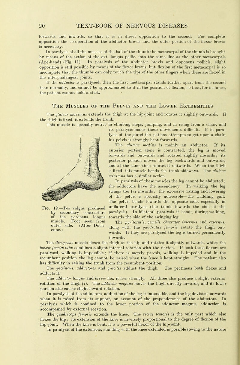 forwards and inwards, so that it is in direct opposition to tlie second. For complete opposition tlie co-operation of the abductor brevis and tlie outer portion of the flexor brevis 13 necessary. In paralysis of all the muscles of the ball of the thumb the metacarpal of the thumb is brought by means of the action of the ext. longus poUic. into the same line as the other metacarpals (Ape-hand) (Fig. 11). In paralysis of the abductor brevLs and opponens poUicis, slight opposition is still possible by means of the flexor brevis, but flexion of the first metacarpal is so incomplete that the thumbs can only touch the tips of the other fingers when these are flexed in the interphalangeal joints. If the adductor is paralysed, then the firet metacarpal stands further apart from the second than normally, and cannot be approximated to it in the position of flexion, so that, for instance, the patient cannot hold a stick. • The Muscles of the Pelvis and the Lower Extremities The gluteus maximus extends the thigh at the hip-joint and rotates it slightly outwards. If the thigh is fixed, it extends the trunk. This muscle is specially active in climbing steps, jumping, and in rising from a chair, and its paralysis makes these movements difficult. If in para- lysis of the glutei the patient attempts to get upon a chair, his pelvis is strongly bent forwards. The gluteus medius is mainly an abductor. If its anterior portion alone is contracted, the leg is moved forwards and outwards and rotated slightly inwards ; its posterior portion moves the leg backwards and outwards, and at the same time rotates it outwards. When the thigh is fixed this muscle bends the trunk sideways. The gluteus minimus has a similar action. In paralysis of these muscles the leg cannot be abducted ; the adductors have the ascendency. In walking the leg swings too far inwards ; the excessive raising and lowering of the pelvis is specially noticeable—the waddling gait. The pelvis bends towards the opposite side, especially in 12_ Pes valgus produced unilateral paralysis (the trunk towards the side of the by secondary contracture paralysis). In bilateral paralysis it bends, durmg walking, of the peroneus longus towards the side of the swinging leg. muscle. _ Foot seen from fj^g pyrijorrnis, gemelli, obturator inlernus and exteriius, outer side. (After Duch- ^j^^ quadratus femoris rotate the thigh out- enne ) o ^ ^ o wards. If they are paralysed the leg is turned permanently inwards. The ileo-psoas muscle flexes the thigh at the hip and rotates it slightly outwards, whilst the tensor fascioB lata combines a slight internal rotation with the flexion. If both these flexors are paralysed, walking is impossible ; if there is merely paresis, walking is impeded and in the recumbent position the leg cannot be raised when the knee is kept straight. The patient also has difficulty in raising the trunk from the recumbent position. The pectineus, adductores and gracilis adduct the thigh. The pectineus both flexes and adducts it. The adductor longus and brevis flex it less strongly. AU three also produce a slight externa rotation of the thigh (?). The adductor magnus moves the thigh directly inwards, and its lower portion also causes slight inward rotation. In paralysis of the adductors, adduction of the leg is impossible, and the leg deviates outwards when it is raised from its support, on account of the preponderance of the abductors. In paralysis which is confined to the lower portion of the adductor magnus, adduction is accompanied by external rotation. The quadriceps femoris extends the knee. The rectus femoris is the only part which also fl.exes the hip ; its extension of the knee is mversely proportional to the degree of flexion of the hip-joint. When the knee is bent, it is a powerful flexor of the hip-joint. In paralysis of the extensors, standing with the knee extended is possible (owing to the nature