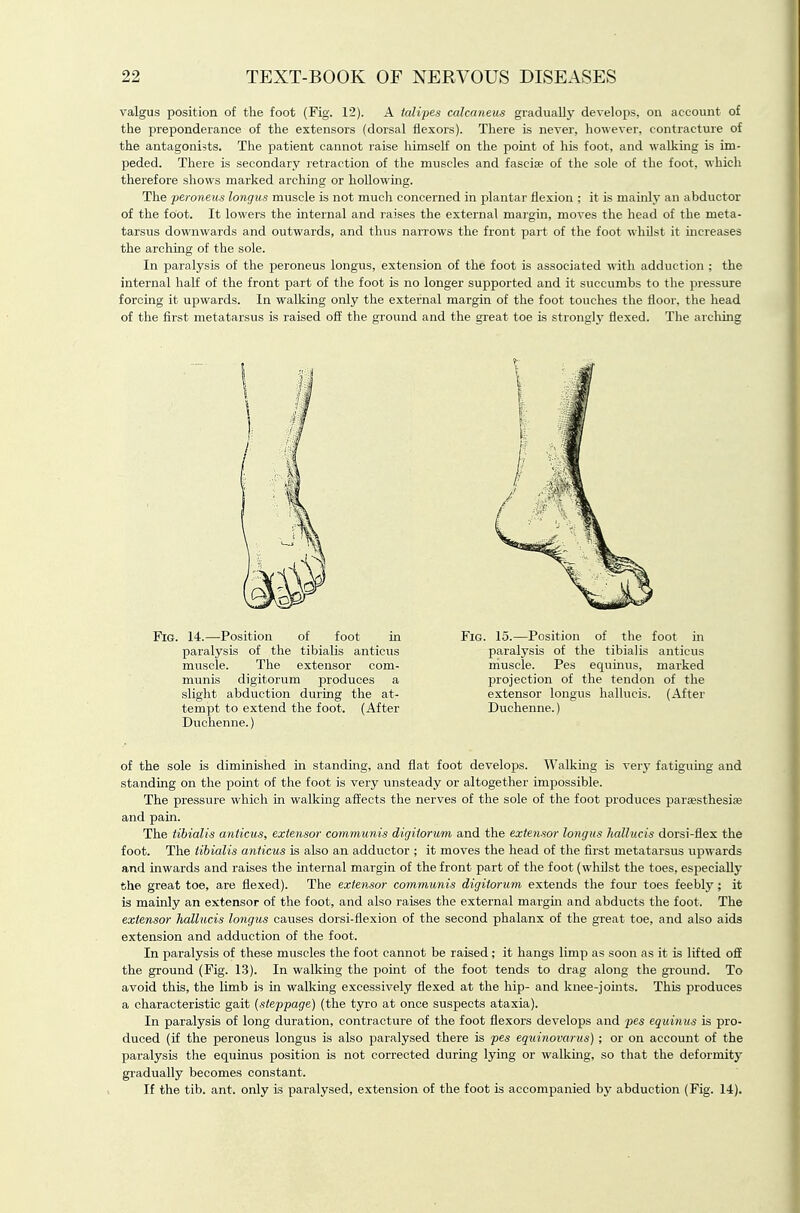 valgus position of the foot (Fig. 12). A talipes calcaneus gradually develops, on account of the preponderance of the extensors (dorsal flexors). There is never, however, contracture of the antagonists. The patient cannot raise himself on the point of his foot, and walking is im- peded. There is secondary retraction of the muscles and fascia? of the sole of the foot, which therefore shows marked arching or hollowing. The peroneus longus muscle is not much concerned in plantar flexion ; it is mainly an abductor of the foot. It lowers the internal and raises the external margin, moves the head of the meta- tarsus downwards and outwards, and thus narrows the front part of the foot whilst it increases the arching of the sole. In paralysis of the peroneus longus, extension of the foot is associated with adduction : the internal half of the front part of the foot is no longer supported and it succumbs to the pressure forcing it upwards. In walking only the external margin of the foot touches the floor, the head of the first metatarsus is raised off the ground and the great toe is strong!}- flexed. The arching of the sole is diminished in standing, and flat foot develops. Walkmg is very fatiguing and standing on the point of the foot is very unsteady or altogether impossible. The pressure which in walking affects the nerves of the sole of the foot produces parcesthesife and pain. The tibialis anticus, extensor communis digiiorum and the extensor longus hallucis dorsi-flex the foot. The tibialis anticus is also an adductor ; it moves the head of the first metatarsus upwards and inwards and raises the internal margin of the front part of the foot (whilst the toes, especiallj- the great toe, are flexed). The extensor communis digitorum extends the four toes feeblj''; it is mainly an extensor of the foot, and also raises the external margm and abducts the foot. The extensor hallucis longus causes dorsi-flexion of the second phalanx of the great toe, and also aids extension and adduction of the foot. In paralysis of these muscles the foot cannot be raised; it hangs limp as soon as it is lifted off the ground (Fig. 13). In walking the point of the foot tends to drag along the ground. To avoid this, the limb is in walking excessively flexed at the hip- and knee-joints. This produces a characteristic gait (steppage) (the tyro at once suspects ataxia). In paralysis of long duration, contracture of the foot flexors develops and pes equinus is pro- duced (if the peroneus longus is also paralysed there is pes equinovarus) ; or on account of the paralysis the equinus position is not corrected during lying or walkmg, so that the deformitj- gradually becomes constant. If the tib. ant. only is paralysed, extension of the foot is accompanied by abduction (Fig. 14). Fig. 14.—Position of foot in paralysis of the tibialis anticus muscle. The extensor com- munis digitorum produces a slight abduction during the at- tempt to extend the foot. (After Duchenne.) Fig. 15.—Position of the foot in paralysis of the tibialis anticus muscle. Pes equmus, marked projection of the tendon of the extensor longus hallucis. (After Duchenne.)