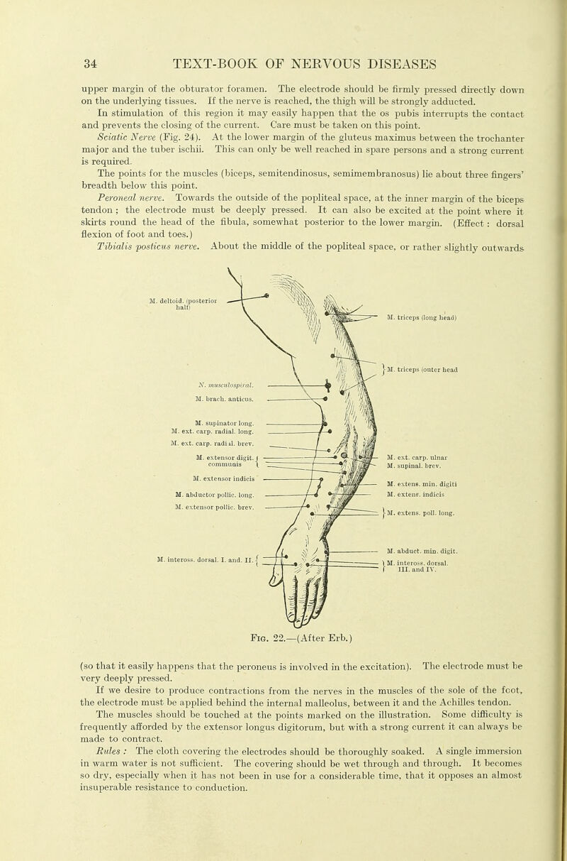 upper margin of the obturator foramen. The electrode should be firmly pressed directly down on the underlying tissues. If the nerve is reached, the thigh wUl be strongly adducted. In stimulation of this region it may easUy happen that the os pubis mterrupts the contact and prevents the closing of the current. Care must be taken on this point. Sciatic Nerve (Fig. 24). At the lower margin of the gluteus maximus between the trochanter major and the tuber ischii. This can only be well reached in spare persons and a strong current is requhed. The points for the muscles (biceps, semitendinosus, semimembranosus) lie about three fingers' breadth below this j)oint. Peroneal nerve. Towards the outside of the popliteal space, at the izmer margin of the biceps tendon; the electrode must be deeply pressed. It can also be excited at the point where it skirts round the head of the fibula, somewhat posterior to the lower margin. (Effect: dorsal flexion of foot and toes.) Tibialis posticus nerve. About the middle of the popliteal space, or rather slightly outwards M. deltoid, (posterior half) musculospti-nl. M. brach. antieus. M. supinator long. M. ext. carp, radial. long. M. ext. carp, radirl. brev. M. extensor digit, commuais M. extensor indicis M. abductor pollic. long. M. extensor pollic. brev. M. inteross. dorsal. I. and. II. | M. triceps (long head) triceps (outer bead M. ext. carp, ulnar M. supinal. brev. M. extens. min. digiti M. extens. indicis M. extens. poll. long. M. abduct, min. digit. M. inteross. dorsal. III. and IV. Fig. 22.—(After Erb.) (so that it easUy happens that the peroneus is involved in the excitation). The electrode must be very deeply pressed. If we desire to produce contractions from the nerves in the muscles of the sole of the foot, the electrode must be applied behind the internal malleolus, between it and the AchiUes tendon. The muscles should be touched at the points marked on the illustration. Some difiiculty is frequently afforded by the extensor longus digitorum, but with a strong current it can always be made to contract. Rules : The cloth covering the electrodes should be thorouglily soaked. A single immersion in warm water is not sufficient. The covering should be wet through and through. It becomes so dry, especially when it has not been in use for a considerable time, that it opposes an almost insuperable resistance to conduction.