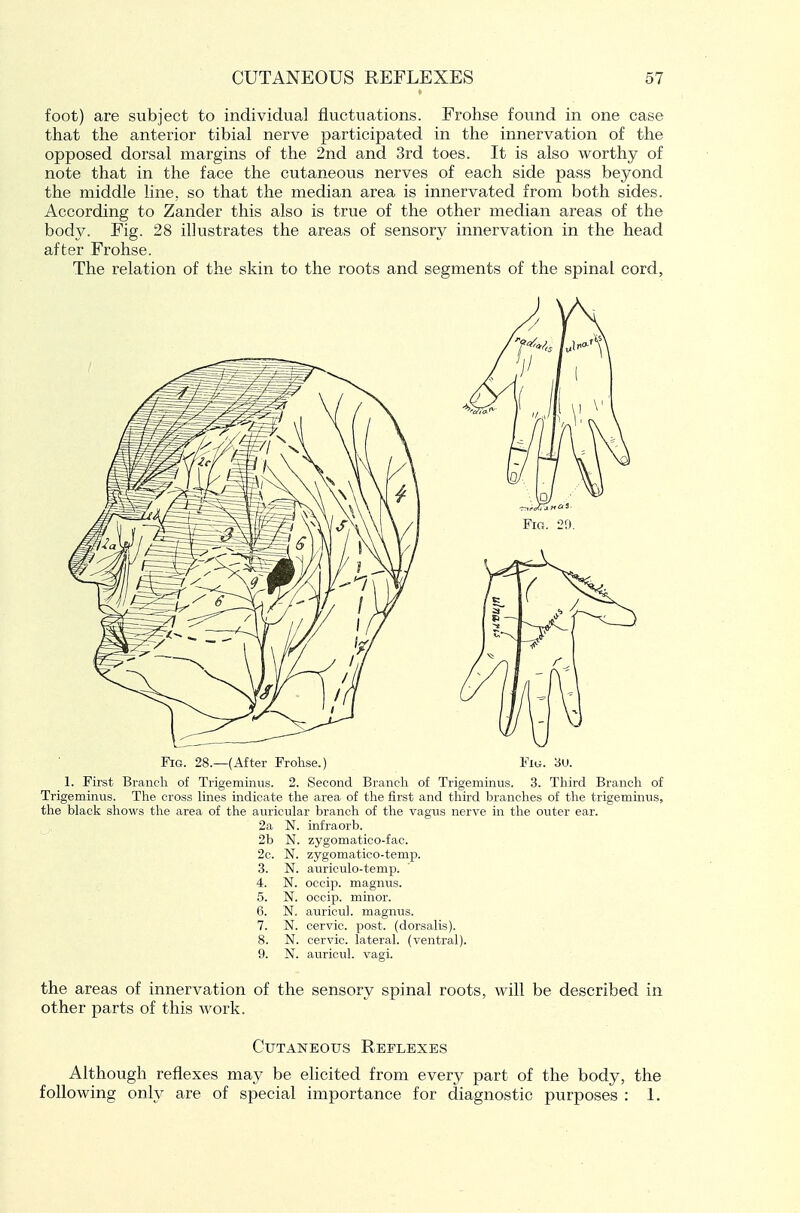 foot) are subject to individual fluctuations. Frohse found in one case that the anterior tibial nerve participated in the innervation of the opposed dorsal margins of the 2nd and 3rd toes. It is also worthy of note that in the face the cutaneous nerves of each side pass beyond the middle line, so that the median area is innervated from both sides. According to Zander this also is true of the other median areas of the body. Fig. 28 illustrates the areas of sensory innervation in the head after Frohse. The relation of the skin to the roots and segments of the spinal cord, Fig. 28.—(After Frohse.) Fig. au. 1. First Branch of Trigeminus. 2. Second Branch of Trigeminus. 3. Third Branch of Trigeminus. The cross lines indicate the area of the first and third branches of the trigeminus, the black shows the area of the auricular branch of the vagus nerve in the outer ear. 2a N. infraorb. 2b N. zygomatico-fac. 2c. N. zygomatico-temp. 3. N. auriculo-temp. 4. N. occip. magnus. 5. N. occip. minor. 6. N. auricu). magnus. 7. N. cervic. post, (dorsalis). 8. N. cervic. lateral, (ventral). 9. N. auricul. vagi. the areas of innervation of the sensory spinal roots, will be described in other parts of this work. Cutaneous Reflexes Although reflexes may be elicited from every part of the body, the following only are of special importance for diagnostic purposes : 1.