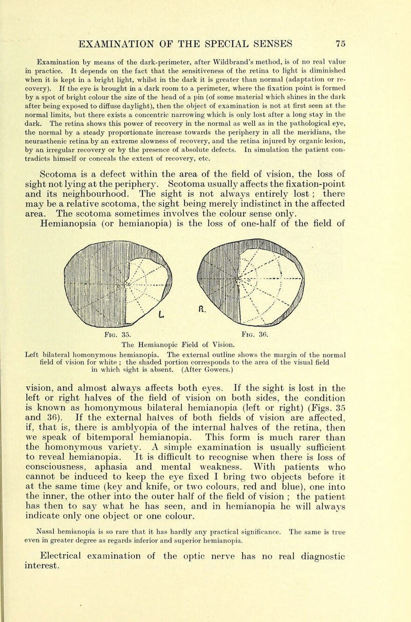 Examination by means of the dark-perimeter, after Wildbrand's method, is of no real vahie in practice. It depends on the fact that the sensitiveness of the retina to light is diminished when it is kept in a bright light, whilst in the dark it is greater than normal (adaptation or re- covery). If the eye is brought in a dark room to a perimeter, where the fixation point is formed by a spot of bright colour the size of the head of a pin (of some material which shines in the dark after being exposed to diffuse daylight), then the object of examination is not at first seen at the normal limits, but there exists a concentric narrowing which is only lost after a long stay in the dark. The retina shows this power of recovery in the normal as well as in the pathological eye, the normal by a steady proportionate increase towards the periphery in all the meridians, the neurasthenic retina by an extreme slowness of recovery, and the retina injured by organic lesion, by an irregular recovery or by the presence of absolute defects. In simulation the patient con- tradicts himself or conceals the extent of recovery, etc. Scotoma is a defect within the area of the field of vision, the loss of sight not lying at the periphery. Scotoma usually affects the fixation-point and its neighbourhood. The sight is not always entirely lost ; there may be a relative scotoma, the sight being merety indistinct in the affected area. The scotoma sometimes involves the colour sense only. Hemianopsia (or hemianopia) is the loss of one-half of the field of Fig. 35. Fig. 30. The Hemianopic Field of Vision. Left bilateral homonymous hemianopia. The external outline shows the margin of the normal field of vision for white ; the shaded portion corresponds to the area of the visual field in which sight is absent. (After Gowers.) vision, and almost always affects both eyes. If the sight is lost in the left or right halves of the field of vision on both sides, the condition is known as homonymous bilateral hemianopia (left or right) (Figs. 35 and 36). If the external halves of both fields of vision are affected, if, that is, there is amblyopia of the internal halves of the retina, then we speak of bitemporal hemianopia. This form is much rarer than the homonymous variety. A simple examination is usually sufficient to reveal hemianopia. It is difficult to recognise when there is loss of consciousness, aphasia and mental weakness. With patients who cannot be induced to keep the eye fixed I bring two objects before it at the same time (key and knife, or two colours, red and blue), one into the inner, the other into the outer half of the field of vision ; the patient has then to say what he has seen, and in hemianopia he will always indicate only one object or one colour. Nasal hemianopia is so rare that it has hardly any practical significance. The same is true even in greater degree as regards inferior and superior hemianopia. Electrical examination of the optic nerve has no real diagnostic interest.