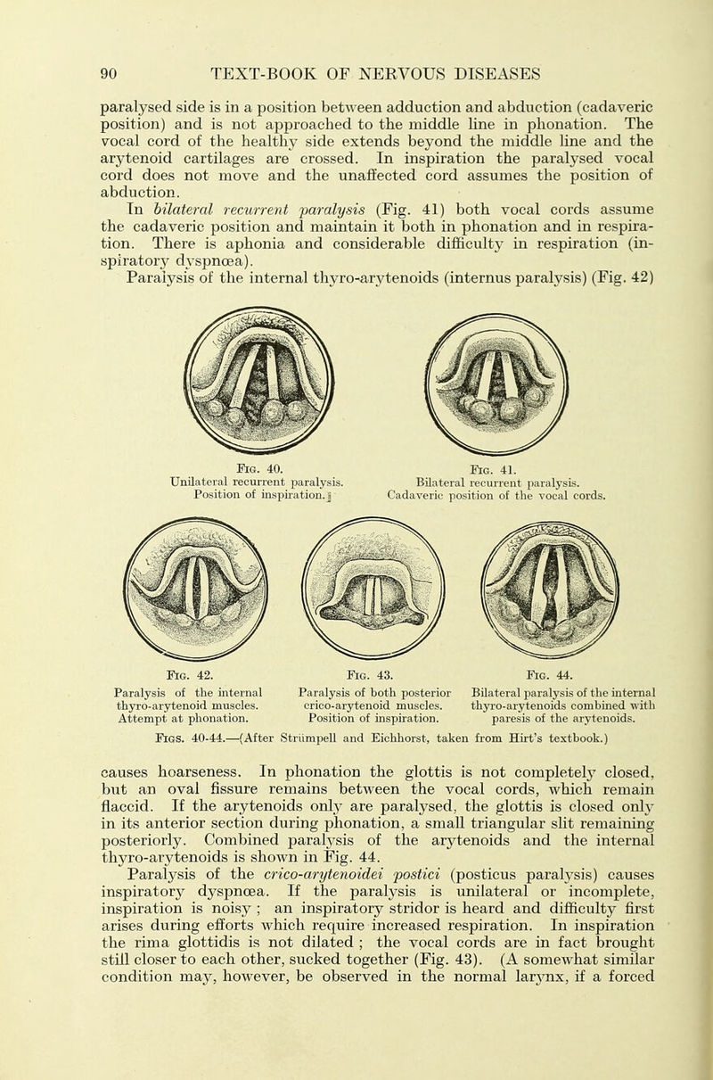 paralysed side is in a position between adduction and abduction (cadaveric position) and is not approached to the middle line in plionation. The vocal cord of the healthy side extends beyond the middle Hne and the arytenoid cartilages are crossed. In inspiration the paralysed vocal cord does not move and the unaffected cord assumes the position of abduction. In bilateral recurrent -paralysis (Fig. 41) both vocal cords assume the cadaveric position and maintain it both in phonation and in respira- tion. There is aphonia and considerable difficulty in respiration (in- spiratory dyspnoea). Paralysis of the internal thyro-^arytenoids (internus paralysis) (Fig. 42) Fig. 40. Unilateral recurrent paralysis. Position of inspii-ation. j • Fig. 41. Bilateral recurrent paralysis. Cadaveric position of the vocal cords. Fig. 42. Paralysis of the internal thyro-arytenoid muscles. Attempt at phonation. Fig. 43. Paralysis of both posterior crico-arytenoid muscles. Position of inspiration. Fig. 44. Bilateral paralysis of the internal th3rro-arytenoids combined with paresis of the arytenoids. Figs. 40-44.—(After Striimpell and Eichhorst, taken from Hirt's textbook.) causes hoarseness. In phonation the glottis is not completely' closed, but an oval fissure remains between the vocal cords, which remain flaccid. If the arytenoids only are paralysed, the glottis is closed onl}' in its anterior section during phonation, a small triangular sht remaining posteriorly. Combined parah^sis of the arytenoids and the internal thyro-arytenoids is shown in Fig. 44. Paralysis of the crico-arytenoidei postici (posticus paralysis) causes inspiratory dyspnoea. If the paralysis is unilateral or incomplete, inspiration is noisy ; an inspiratory stridor is heard and difficulty first arises during efforts which require increased respiration. In inspiration the rima glottidis is not dilated ; the vocal cords are in fact brought still closer to each other, sucked together (Fig. 43). (A somewhat similar condition may, however, be observed in the normal larynx, if a forced