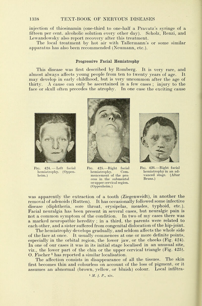 injection of thiosinamin (one-third to one-half a Pravatz's syringe of a fifteen per cent, alcoholic solution every other day). Scholz, Renzi, and Lewandowsky also report recovery after this treatment. The local treatment by hot air with Tallermann's or some similar apparatus has also been recommended (Neumann, etc.). Progressive Facial Hemiatrophy This disease was first described by Romberg. It is very rare, and almost always affects young people from ten to twenty years of age. It may develop in early childhood, but is very uncommon after the age of thirty. A cause can only be ascertained in a few cases ; injury to the face or skull often precedes the atrophy. In one case the exciting cause Fig. 424. — Left facial hemiatrophy. (Oppen- heim.) Fig. 425.—Right facial hemiatrophy. Com- mencement of the pro- cess in the submental or upper cervical region. (Oppenheim.) Fig. 426.—Right facial hemiatrophy in an ad- vanced stage. (After Bruns.) was apparently the extraction of a tooth (Ziegenweidt), in another the removal of adenoids (Rutten). It has occasionally followed some infective disease (diphtheria, sore throat, erysipelas, measles, typhoid, etc.). Facial neuralgia has been present in several cases, but neuralgic pain is not a common symptom of the condition. In two of my cases there was a marked neuropathic heredity ; in a third, the parents were related to each other, and a sister suffered from congenital dislocation of the hip-joint. The hemiatrophy develops gradually, and seldom affects the whole side of the face at once. It usually commences at one or more definite points, especially in the orbital region, the lower jaw, or the cheeks (Fig. 424). In one of our cases it was in its initial stage localised in an unusual site, viz., the lower part of the chin or the upper cervical triangle (Fig. 425). O. Fischer ^ has reported a similar localisation. The affection consists in disappearance of all the tissues. The skin first becomes thin and colourless on account of the loss of pigment, or it assumes an abnormal (brown, yellow, or bluish) colour. Local infiltra- 1M. f. P., xiv.