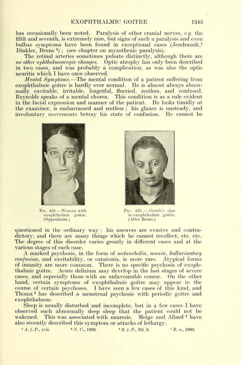 has occasionally been noted. Paralysis of other cranial nerves, e.g. the fifth and seventh, is extremely rare, but signs of such a paralysis and even bulbar symptoms have been found in exceptional cases (Jendrassik,^ Dinkier, Bruns ^) ; (see chapter on myasthenic paralysis). The retinal arteries sometimes pulsate distinctly, although there are no other ophthahnosco-pic changes. Optic atrophy has only been described in two cases, and was probably a complication, as was also the optic neuritis which I have once observed. Mental Symptoms.—The mental condition of a patient suffering from exophthalmic goitre is hardly ever normal. He is almost always abnor- mally excitable, irritable, forgetful, flurried, restless, and confused. Reynolds speaks of a mental chorea. This condition is as a rule evident in the facial expression and manner of the patient. He looks timidly at the examiner, is embarrassed and restless ; his glance is unsteady, and involuntary movements betray his state of confusion. He cannot be questioned in the ordinary way ; his answers are evasive and contra- dictory, and there are many things which he cannot recollect, etc. etc. The degree of this disorder varies greatly in different cases and at the various stages of each case. A marked psychosis, in the form of melancholia, mania, hallucinatory confusion, and excitability, or catatonia, is more rare. Atypical forms of insanity are more common. There is no specific psychosis of exoph- thalmic goitre. Acute delirium may develop in the last stages of severe cases, and especially those with an unfavourable course. On the other hand, certain symptoms of exophthalmic goitre may appear in the course of certain psychoses. I have seen a few cases of this kind, and Thoma^ has described a menstrual psychosis v/ith periodic goitre and exophthalmus. Sleep is usually disturbed and incomplete, but in a few cases I have observed such abnormally deep sleep that the patient could not be wakened. This was associated with enuresis. Meige and Allard * have also recently described this symptom or attacks of lethargy. 1 A. f. P., xvii. 2 N. C, 1903. ^ z. f. P., Bd. li. ^ E. n., 1900. Fig. 428.—Woman with exophthalmic goitre. (Oppenheim.) Fia. 429. — Graefe's sign in exophthalmic goitre. (After Bruns.)