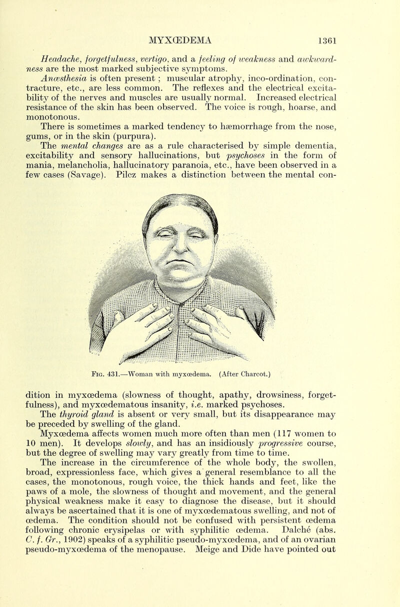 Headache, jorgetjulness, vertigo, and a feeling of weakness and awkward- ness are the most marked subjective symptoms. Anaesthesia is often present ; muscular atrophy, inco-ordination, con- tracture, etc., are less common. The reflexes and the electrical excita- bility of the nerves and muscles are usually normal. Increased electrical resistance of the skin has been observed. The voice is rough, hoarse, and monotonous. There is sometimes a marked tendency to hsemorrhage from the nose, gums, or in the skin (purpura). The mental changes rule characterised by simple dementia, excitability and sensory hallucinations, but psychoses in the form of mania, melancholia, hallucinatory paranoia, etc., have been observed in a few cases (Savage). Pilcz makes a distinction between the mental con- dition in myxoedema (slowness of thought, apathy, drowsiness, forget- fulness), and myxoedematous insanity, i.e. marked psychoses. The thyroid gland is absent or very small, but its disappearance may be preceded by swelling of the gland. Myxoedema affects women much more often than men (117 women to 10 men). It develops sloivly, and has an insidiously j^fogressive course, but the degree of swelling may vary greatly from time to time. The increase in the circumference of the whole body, the swollen, broad, expressionless face, which gives a general resemblance to all the cases, the monotonous, rough voice, the thick hands and feet, like the paws of a mole, the slowness of thought and movement, and the general physical weakness make it easy to diagnose the disease, but it should always be ascertained that it is one of myxoedematous swelling, and not of oedema. The condition should not be confused with persistent oedema following chronic erysipelas or with syphilitic oedema. Dalche (abs. C. f. Gr., 1902) speaks of a syphilitic pseudo-myxoedema, and of an ovarian pseudo-myxoedema of the menopause. Meige and Dide have pointed out Fig. 431.—Woman with myxoedema. (After Charcot.)