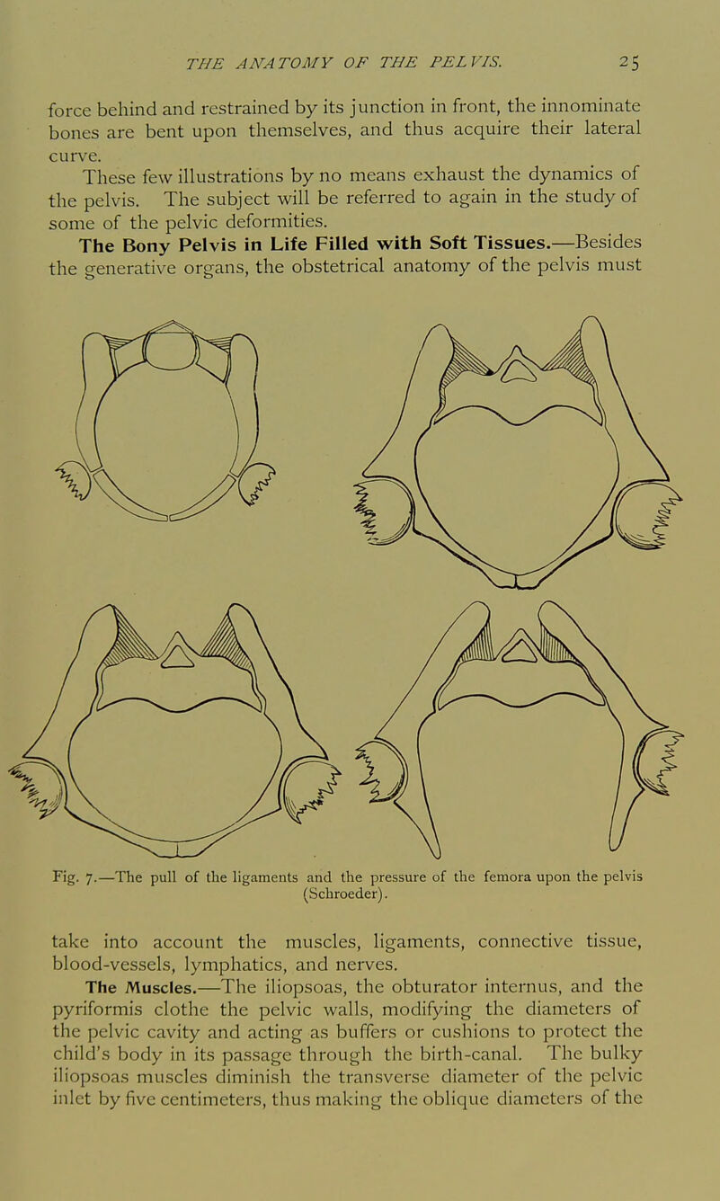 force behind and restrained by its junction in front, the innominate bones are bent upon themselves, and thus acquire their lateral curve. These few illustrations by no means exhaust the dynamics of the pelvis. The subject will be referred to again in the study of some of the pelvic deformities. The Bony Pelvis in Life Filled with Soft Tissues.—Besides the generative organs, the obstetrical anatomy of the pelvis must Fig. 7.—The pull of the ligaments and the pressure of the femora upon the pelvis (Schroeder). take into account the muscles, ligaments, connective tissue, blood-vessels, lymphatics, and nerves. The Muscles.—The iliopsoas, the obturator internus, and the pyriformis clothe the pelvic walls, modifying the diameters of the pelvic cavity and acting as buffers or cushions to protect the child's body in its pa.ssage through the birth-canal. The bulky iliopsoas muscles diminish the transverse diameter of the pelvic inlet by five centimeters, thus making the oblique diameters of the