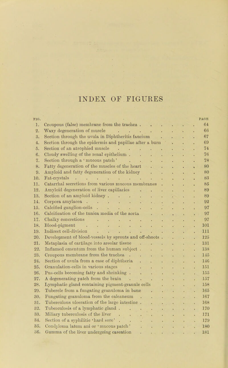 INDEX OF FIGUKES FIG. PAGE 3. Croupous (false) membrane from the trachea 64 2. Waxy degeneration of muscle . 66 3. Section through the uvula in Diphtheritis faucium .... 67 4. Section through the epidermis and papillae after a burn ... 69 5. Section of an atrophied muscle 74 6. Cloudy swelling of the renal epithelium 76 7. Section through a 1 mucous patch' 78 8. Fatty degeneration of the muscles of the heart 80 9. Amyloid and fatty degeneration of the kidney 80 10. Fat-crystals 83 11. Catarrhal secretions from various mucous membranes .... 85 12. Amyloid degeneration of liver capillaiies 89 13. Section of an amyloid kidney . .89 14. Corpora amylacea 92 15. Calcified ganglion-cells 97 16. Calcification of the tunica media of the aorta 97 17. Chalky concretions 97 18. Blood-pigment . 101 19. Indirect cell-division . . . Ill 20. Development of blood-vessels by sprouts and off-shoots .... 125 21. Metaplasia of cartilage into areolar tissue 131 22. Inflamed omentum from the human subject ...... 133 23. Croupous membrane from the trachea ....... 115 24. Section of uvula from a case of diphtheria . , .... 140 25. Granulation-cells in various stages ....... 151 26. Pus-cells becoming fatty and shrinking 155 27. A degenerating patch from the brain 157 28. Lymphatic gland containing pigment-granule cells .... 158 29. Tubercle from a fungating granuloma in bone 165 30. Fungating granuloma from the calcaneum ...... 167 31. Tuberculous ulceration of the large intestine 168 32. Tubeiculosis of a lymphatic gland 170 33. Miliary tuberculosis of the liver . 171 34. Section of a syphilitic'hard sore' 179 35. Condyloma latum ani or ' mucous patch ' ...... 180 36. Gumma of the liver undergoing caseation 181