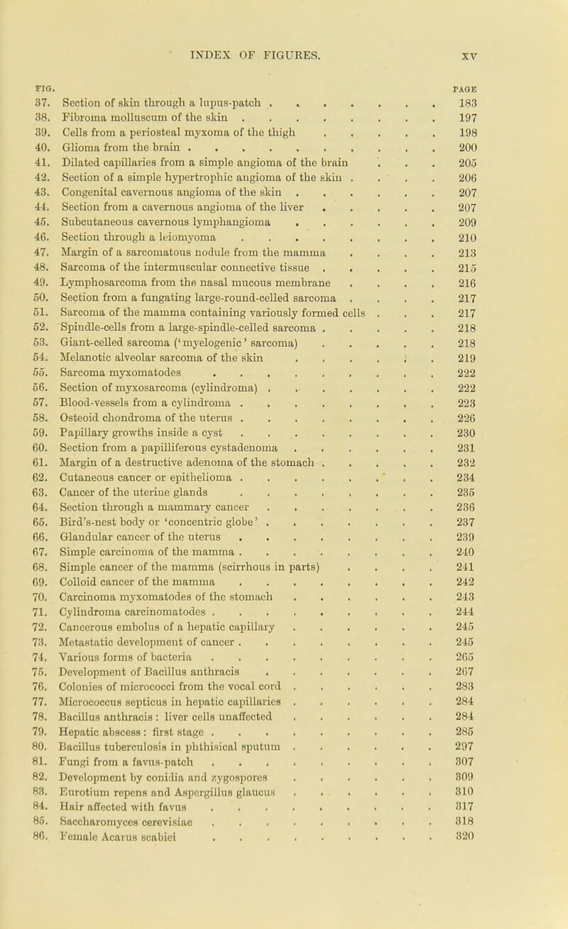 FIG. PAGE 37. Section of skin through a lupus-patch . 183 38. Fibroma inolluscum of the skin 197 39. Cells from a periosteal myxoma of the thigh 198 40. Glioma from the brain 200 41. Dilated capillaries from a simple angioma of the brain . . . 205 42. Section of a simple hypertrophic angioma of the skin . . ' . 206 43. Congenital cavernous angioma of the skin 207 44. Section from a cavernous angioma of the liver 207 45. Subcutaneous cavernous lymphangioma 209 46. Section through a leiomyoma 210 47. Margin of a sarcomatous nodule from the mamma .... 213 48. Sarcoma of the intermuscular connective tissue 215 49. Lymphosarcoma from the nasal mucous membrane .... 216 50. Section from a fungating large-round-celled sarcoma .... 217 51. Sarcoma of the mamma containing variously formed cells . . . 217 52. Spindle-cells from a large-spindle-celled sarcoma 218 53. Giant-celled sarcoma (' myelogenic ' sarcoma) 218 54. Melanotic alveolar sarcoma of the skin .... J . 219 55. Sarcoma nryxomatodes 222 56. Section of myxosarcoma (cylindroma) . 222 57. Blood-vessels from a cylindroma 223 58. Osteoid chondroma of the uterus 226 59. Papillary growths inside a cyst 230 60. Section from a papuliferous cystadenoma 231 61. Margin of a destructive adenoma of the stomach 232 62. Cutaneous cancer or epithelioma ' . . 234 63. Cancer of the uterine glands 235 64. Section through a mammary cancer 236 65. Bird's-nest body or'concentric globe' 237 66. Glandular cancer of the uterus 239 67. Simple carcinoma of the mamma 240 68. Simple cancer of the mamma (scirrhous in parts) .... 241 69. Colloid cancer of the mamma 242 70. Carcinoma myxomatodes of the stomach 243 71. Cylindroma carcinomatodes 244 72. Cancerous embolus of a hepatic capillary 245 73. Metastatic development of cancer 245 74. Various forms of bacteria 265 75. Development of Bacillus anthracis 2(17 76. Colonies of micrococci from the vocal cord 283 77. Micrococcus septicus in hepatic capillaries 284 78. Bacillus anthracis : liver cells unaffected 284 79. Hepatic abscess : first stage 285 80. Bacillus tuberculosis in phthisical sputum 297 81. Fungi from a favus-patch 307 82. Development by conidia and zygospores 309 83. Eurotium repens and Aspergillus glaucus 310 84. Hair affected with favus 317 85. Saccharomyces cerevisiae ......... 318 86. Female Acarus scabiei 320