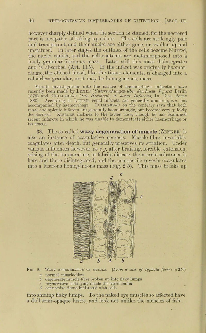 however sharply defined when the section is stained, for the necrosed part is incapable of taking up colour. The cells are strikingly pale and transparent, and their nuclei are either gone, or swollen up and unstained. In later stages the outlines of the cells become blurred, the nuclei vanish, and the cell-contents are metamorphosed into a finely-granular fibrinous mass. Later still this mass disintegrates and is absorbed (Art. 115). If the infarct was originally haemor- rhagic,the effused blood, like the tissue-elements, is changed into a colourless granular, or it may be homogeneous, mass. Minute investigations into the nature of haeniorrhagic infarction have recently been made by Litten (Untersuchungen iiber den haem. Infarct Berlin 1879) and Guillebeau (Die Ilistologie d. haem. Jnfarctes, In. Diss. Berne 1880) . According to Litten, renal infarcts are generally anaemic, i. e. not accompanied by haemorrhage. Guillebeau on the contrary says that both renal and splenic infarcts are generally haeniorrhagic, but become very quickly decolorised. Ziegler inclines to the latter view, though he has examined recent infarcts in which he was unable to demonstrate either haemorrhage or its traces. 38. The so-called waxy degeneration of muscle (Zenker) is also an instance of coagulative necrosis. Muscle-fibre invariably coagulates after death, but generally preserves its striation. Under various influences however, as e.g. after bruising, forcible extension, raising of the temperature, or febrile disease, the muscle substance is here and there disintegrated, and the contractile myosin coagulates into a lustrous homogeneous mass (Fig. 2 b). This mass breaks up Pig. 2. Waxy degeneration or muscle. (From a case of typhoid fiver: x 250) a normal muscle-fibre b degenerate muscle-fibre broken up into flaky lumps c regenerative cells lying inside the sarcolemma d connective tissue infiltrated with cells into shining flaky lumps. To the naked eye muscles so affected have a dull semi-opaque lustre, and look not unlike the muscles of fish.