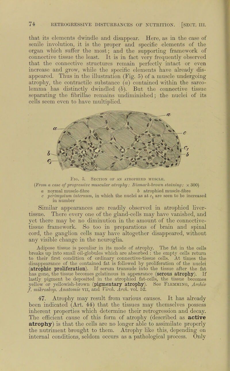 that its elements dwindle and disappear. Here, as in the case of senile involution, it is the proper and specific elements of the organ which suffer the most; and the supporting framework of connective tissue the least. It is in fact very frequently observed that the connective structures remain perfectly intact or even increase and grow, while the specific elements have already dis- appeared. Thus in the illustration (Fig. 5) of a muscle undergoing atrophy, the contractile substance (a) contained within the sarco- lemma has distinctly dwindled (b). But the connective tissue separating the fibrillae remains undiminished; the nuclei of its cells seem even to have multiplied. Fig. 5. Section or an atrophied muscle. (From a case of progressive muscular atrophy: Bismark-brown staining: x 300) a normal muscle-fibre b atrophied muscle-fibre c perimysium internum, in which the nuclei as at c-, are seen to be increased in number Similar appearances are readily observed in atrophied liver- tissue. There every one of the gland-cells may have vanished, and yet there may be no diminution in the amount of the connective- tissue framework. So too in preparations of brain and spinal cord, the ganglion cells may have altogether disappeared, without any visible change in the neuroglia. Adipose tissue is peculiar in its mode of atrophy. The fat in the cells breaks up into small oil-globules which are absorbed : the empty cells return to their first condition of ordinary connective-tissue cells. At times the disappearance of the contained fat is followed by proliferation of the nuclei (atrophic proliferation). If serum transude into the tissue after the fat has gone, the tissue becomes gelatinous in appearance (serous atrophy). If lastly pigment be deposited in the atrophied fat-cells, the tissue becomes yellow or yellowish-brown (pigmentary atrophy). See Flemming, Archiv f. mikroskop. Anatomie vn, and Virch. Arch. vol. 52. 47. Atrophy may result from various causes. It has already been indicated (Art. 44) that the tissues may themselves possess inherent properties which determine their retrogression and decay. The efficient cause of this form of atrophy (described as active atrophy) is that the cells are no longer able to assimilate properly the nutriment brought to them. Atrophy like this, depending on internal conditions, seldom occurs as a pathological process. Only