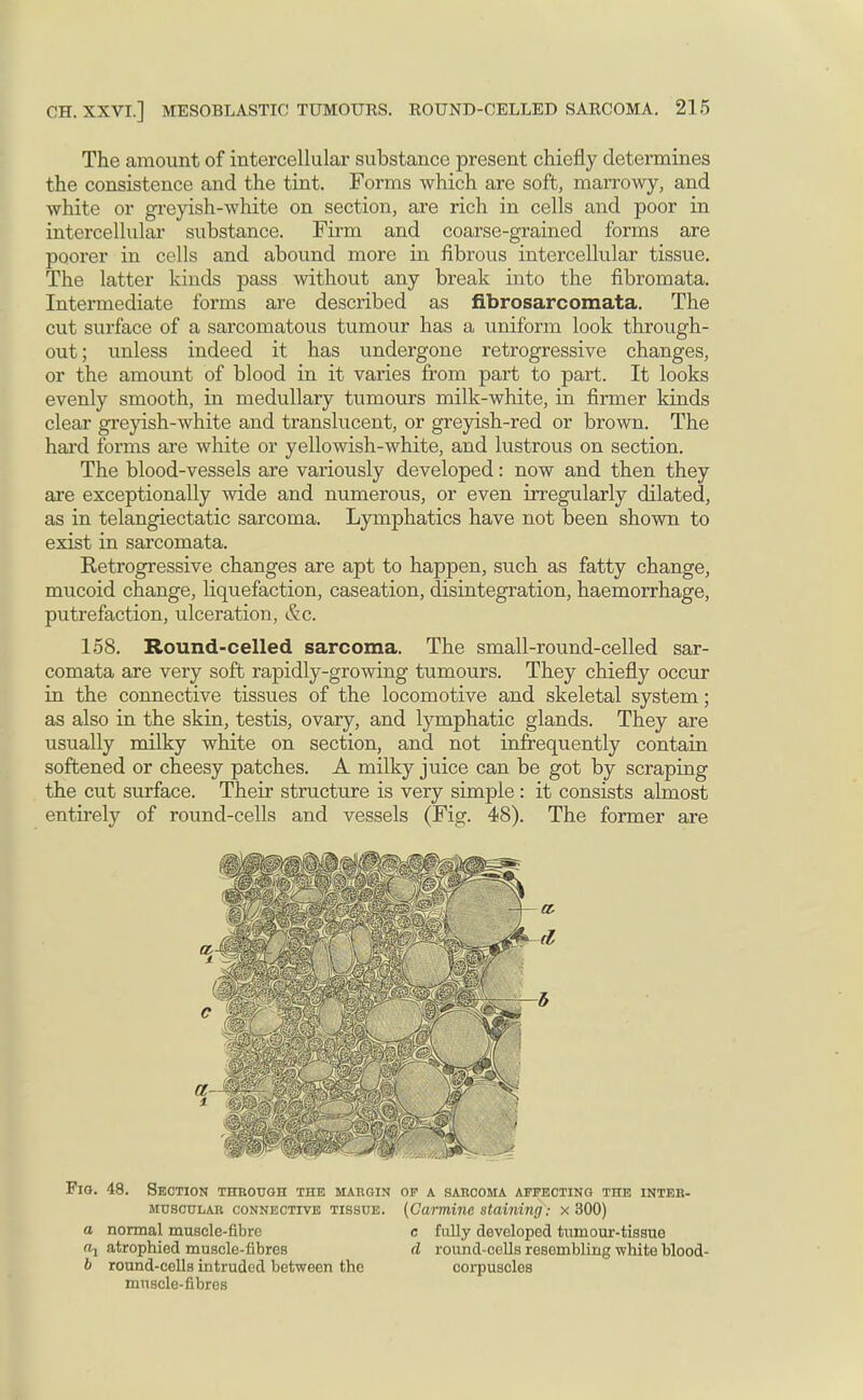 The amount of intercellular substance present chiefly determines the consistence and the tint. Forms which are soft, marrowy, and white or greyish-white on section, are rich in cells and poor in intercellular substance. Firm and coarse-grained forms are poorer in cells and abound more in fibrous intercellular tissue. The latter kinds pass without any break into the fibromata. Intermediate forms are described as fibrosarcomata. The cut surface of a sarcomatous tumour has a uniform look through- out; unless indeed it has undergone retrogressive changes, or the amount of blood in it varies from part to part. It looks evenly smooth, in medullary tumours milk-white, in firmer kinds clear greyish-white and translucent, or greyish-red or brown. The hard forms are white or yellowish-white, and lustrous on section. The blood-vessels are variously developed: now and then they are exceptionally wide and numerous, or even irregularly dilated, as in telangiectatic sarcoma. Lymphatics have not been shown to exist in sarcomata. Ketrogressive changes are apt to happen, such as fatty change, mucoid change, liquefaction, caseation, disintegration, haemorrhage, putrefaction, ulceration, &c. 158. Round-celled sarcoma. The small-round-celled sar- comata are very soft rapidly-growing tumours. They chiefly occur in the connective tissues of the locomotive and skeletal system; as also in the skin, testis, ovary, and lymphatic glands. They are usually milky white on section, and not infrequently contain softened or cheesy patches. A milky juice can be got by scraping the cut surface. Their structure is very simple: it consists almost entirely of round-cells and vessels (Fig. 48). The former are Fig. 48. Section through the margin of a sarcoma affecting the inter- muscular connective tissue. (Carmine staining: x 300) a normal muscle-fibre c fully developed tumour-tissue «i atrophied muscle-fibres d round-cells resembling white blood- b round-cells intruded between the corpuscles muscle-fibres