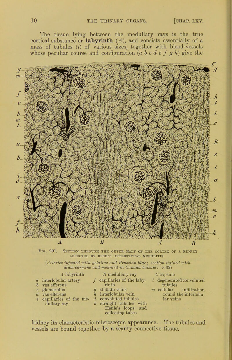 The tissue lying between the medullary rays is the true cortical substance or labyrinth (A), and consists essentially of a mass of tubules (i) of various sizes, together with blood-vessels whose peculiar course and configuration (a b c d e f g h) give the Fig. 201. Section through the outer half of the cortex of a kidney affected by recent interstitial nephritis. (Arteries injected with gelatine and Prussian blue; section stained tvith alum-carmine and mounted in Canada balsam: x 32) A labyrinth a interlobular artery b vas afferens c glomerulus d vas efferens e capillaries of the me- dullary ray B medullary ray / capillaries of the laby- rinth g stellate veins /( interlobular vein i convoluted tubules h straight tubules with Henle's loops and collecting tubes C capsule I degenerated convoluted tubules m cellular infiltration round tbe interlobu- lar veins kidney its characteristic microscopic appearance. The tubules and vessels are bound together by a scanty connective tissue.