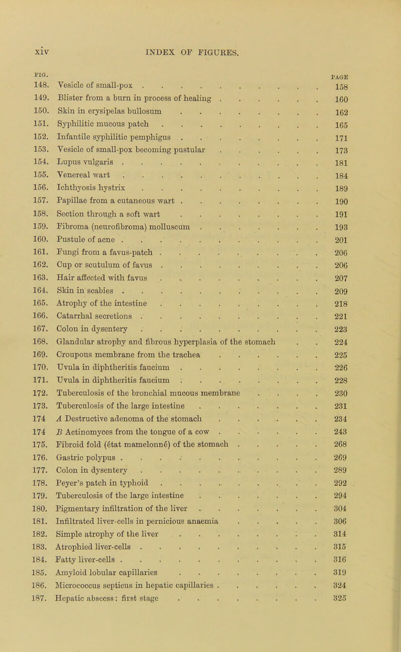 I'AGE 148. Vesicle of small-pox I53 149. Blister from a burn in process of healing 160 150. Skin in erysipelas bullosum 162 151. Syphilitic mucous patch 165 152. Infantile syphilitic pemphigus 171 153. Vesicle of small-pox becoming pustular I73 154. Lupus vulgaris 181 155. Venereal wart 184 156. Ichthyosis hystrix 189 157. Papillae from a cutaneous wart 190 158. Section through a soft wart 191 159. Fibroma (neurofibroma) molluscum 193 160. Pustule of acne 201 161. Fungi from a favus-patch 206 162. Cup or scutulum of favus 206 163. Hair affected with favus 207 164. Skin in scabies 209 165. Atrophy of the intestine 218 166. Catarrhal secretions 221 167. Colon in dysentery 223 168. Glandular atrophy and fibrous hyperplasia of the stomach . . 224 169. Croupous membrane from the trachea 225 170. Uvula in diphtheritis faucium 226 171. Uvula in diphtheritis faucium 228 172. Tuberculosis of the bronchial mucous membrane .... 230 173. Tuberculosis of the large intestine 231 174 A Destructive adenoma of the stomach 234 174 B Actinomyces from the tongue of a cow 243 175. Fibroid fold (6tat mamelonng) of the stomach 268 176. Gastric polypus 269 177. Colon in dysentery 289 178. Peyer's patch in typhoid . 292 179. Tuberculosis of the large intestine 294 180. Pigmentary infiltration of the liver 304 181. Infiltrated liver-cells in pernicious anaemia 306 182. Simple atrophy of the liver . 314 183. Atrophied liver-cells 315 184. Fatty liver-ceUs 316 185. Amyloid lobular capillaries 319 186. Micrococcus septicus in hepatic capillaries 324 187. Hepatic abscess: first stage ........ 325