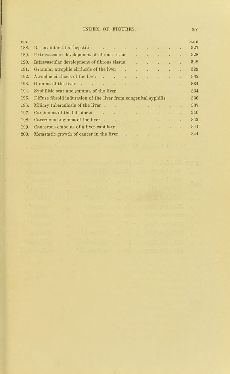 i-ia. PAGE 188. Recent interstitial hepatitis 327 189. Extravascular development of fibrous tissue 328 190. Intravascular development of fibrous tissue 328 191. Granular atrophic cii'rhosis of the liver 329 192. Atrophic cirrhosis of the liver 332 193. Gumma of the liver 334 194. Syphilitic scar and gumma of the liver 334 195. Diliuse fibroid induration of the Uver from congenital syphilis . . 336 196. MiUary tuberculosis of the liver 337 197. Carcinoma of the bile-ducts 340 198. Cavernous angioma of the liver 342 199. Cancerous embolus of a hver-capillary ...... 344 200. Metastatic growth of cancer in the liver 344