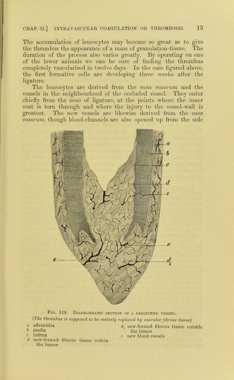 The accumulation of leucocytes may become so great as to give the thrombus the appearance of a mass of granulation-tissue. The duration of the process also varies greatly. By operating on one of the lower animals we can be sure of finding the thrombus completely vascularised in twelve days. In the case figured above, the first formative cells are developing three weeks after the ligature. The leucocytes are derived from the vasa vasorum and the vessels in the neighbourhood of the occluded vessel. They enter chiefly from the zone of ligature, at the points where the inner coat is torn through and where the injury to the vessel-wall is gi'eatest. The new vessels are likewise derived from the vasa vasorum, though blood-channels are also opened up from the side Fig. 119. Diagrammatio section of a lioatured vessel. (The thrombus is sxipposcd to be entirely replaced by vascular fibrous tissue) a adventitia new-formed fibrous tissue outside ^ pedia the lumen c mtuna g new blood-vessels d new-formed fibrous tissue within the lumen