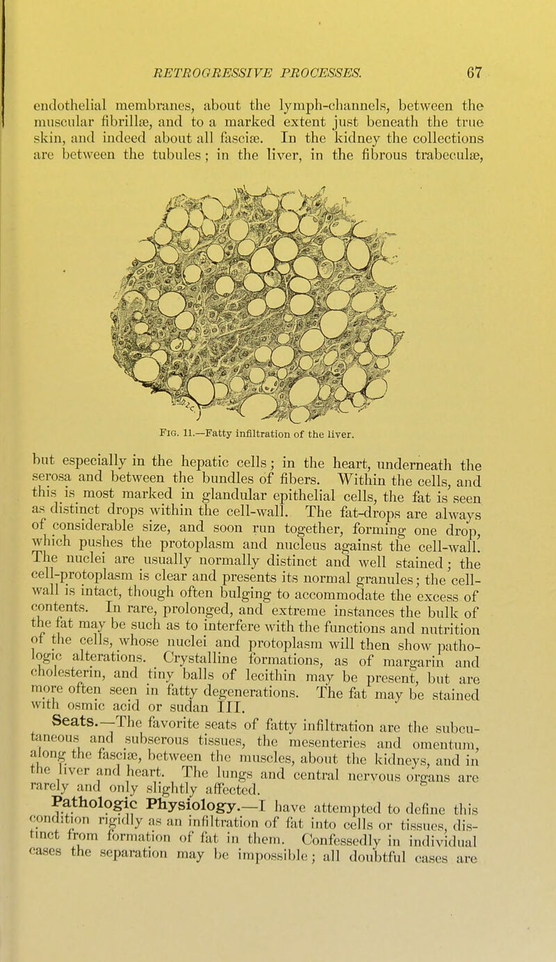 endothelial membranes, about the lymph-channels, between the muscular fibrillte, and to a marked extent just beneath the true skin, and indeed about all fascige. In the kidney the collections are between the tubules; in the liver, in the fibrous trabeculae, Fig. 11.—Fatty infiltration of the liver. but especially in the hepatic cells; in the heart, underneath the serosa and between the bundles of fibers. Within the cells, and this is most marked in glandular epithelial cells, the fat is seen as distinct drops within the cell-wall. The fat-drops are always of considerable size, and soon run together, forming one drop, which pushes the protoplasm and nucleus against the cell-wall! The nuclei are usually normally distinct and well stained; the cell-protoplasm is clear and presents its normal granules; the cell- wall is intact, though often bulging to accommodate the excess of contents. In rare, prolonged, and extreme instances the bulk of the fat may be such as to interfere with the functions and nutrition of the cells, whose nuclei and protoplasm will then show patho- logic alterations. Crystalline formations, as of margarin and cholesterin, and tiny balls of lecithin may be present, but are more often seen in fatty degenerations. The fat may be stained with osmic acid or sudan III. Seats.—The favorite seats of fatty infiltration are the subcu- taneou.s and subserous tissues, the mesenteries and omentum, along the fasciae, between the muscles, about the kidneys, and in the liver and heart. The lungs and central nervous oVeans are rarely and only slightly affected. Pathologic Physiology.—I have attempted to define this condition rigidly as an infiltration of fat into cells or tissues, dis- tinct from formation of fat in them. Confessedly in individual cases the separation may be impossible; all doubtful cases are
