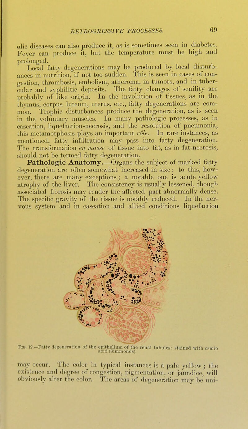 olic diseases can also produce it, as is sometimes seen in diabetes. Fever can produce it, but tlie temperature must be higli and prolonged. Local fatty degenerations may be produced by local disturb- ances in nutrition, if not too sudden. This is seen in cases of con- gestion, thrombosis, embolism, atheroma, in tumors, and in tuber- cular and syphilitic deposits. The fatty changes of senility are probably of like origin. In the involution of tissues, as in the tiiymus, corpus luteum, uterus, etc., fatty degenerations are com- mon. Trophic disturbances produce the degeneration, as is seen in the voluntary muscles. In many pathologic processes, as in caseation, liquefaction-necrosis, and the resolution of pneumonia, this metamorphosis plays an important role. In rare instances, as mentioned, fatty infiltration may pass into fatty degeneration. The transformation en masse of tissue into fat, as in fat-necrosis, should not be termed fatty degeneration. Pathologic Anatomy.—Organs the subject of marked fatty degeneration are often somewhat increased in size: to this, how- ever, there are many exceptions; a notable one is acute yellow atrophy of the liver. The consistency is usually lessened, though associated fibrosis may render the affected part abnormally dense. The specific gravity of the tissue is notably reduced. In the ner- vous system and in caseation and allied conditions liquefaction Fio. 12—Fatty degeneration of the epithelium of the renal tubules; stained with osmic ncid (Simnionds). may occur. The color in typical instances is a pale yellow; the existence and degree of congestion, pigmentation, or jaundice, will obviously alter the color. The areas of degeneration may be uni-