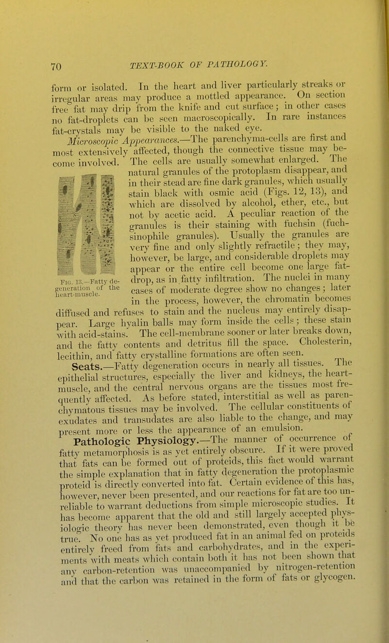 Fig. IS.- form or isolated. In the heart and liver particularly streaks or irregular areas may produce a mottled appearance. On section free fat may drip from the knife and cut surface; in other cases no fat-droplets can be seen macroscopically. In rare instances Microscopic Appearances.—Tha parenchyma-cells are first and most extensively aifected, though the connective tissue may be- come involved. The cells are usually somewhat enlarged. The natural granules of the protoplasm disappear, and W: in their stead are fine dark granules, which usually if» stain black with osmic acid (Figs. 12, 13), and which are dissolved by alcohol, ether, etc., but T'i not by acetic acid. A peculiar reaction of the granules is their staining with fuchsin (fuch- sinophile granules). Usually the granules are j'l? very fine and only slightly refractile; they may, however, be large, and considerable droplets may appear or the entire cell become one large fat- r.u. ...-Fatty de- drop, as in fatty infiltration. The nuclei in many heart m°sci(f^ cases of moderate degree show no changes ; later ear -mubc c. ^^^^ process, howcvcr, the chromatin becomes diffused and refuses to stain and the nucleus may entirely disap- pear. Large hyalin balls may form inside the cells; these stain with acid-stains. The cell-membrane sooner or later breaks Ao-^m, and the fatty contents and detritus fill the space. Cholestenn, lecithin, and fatty crystalline formations are often seen. Seats.—Fatty degeneration occurs in nearly all tissues, ihe epithelial structures, especially the liver and kidneys, the heart- muscle, and the central nervous organs are the tissues most tre- quently affected. As before stated, interstitial as well as paren- chymatous tissues may be involved. The cellular constituents ot exudates and transudates are also liable to the change, and may present more or less the appearance of an emulsion. Pathologic Physiology.—The manner of occurrence ot fatty metamorphosis is as yet entirely obscure. If it were proved that fats can be formed out of proteids, this fact would warrant the simple explanation that in fatty degeneration the protoplasmic proteid is directly converted into fat. Certain evidence of this has, however, never been presented, and our reactions for fat are too un- reliable to warrant deductions from simple microscopic studies, it has become apjiarent that the old and still largely accepted phys- ioloo-ic theory has never been demonstrated, even though it be true'' No one has as vet produced fat in an animal fed on proteids entirely freed from fats and carbohydrates, and in the experi- ments with meats which contain both it luis not been shown that any carbon-retention was uiiaccompanicKl by nitrogen-retention and that the carbon Avas retained in the form of fats or glycogen.