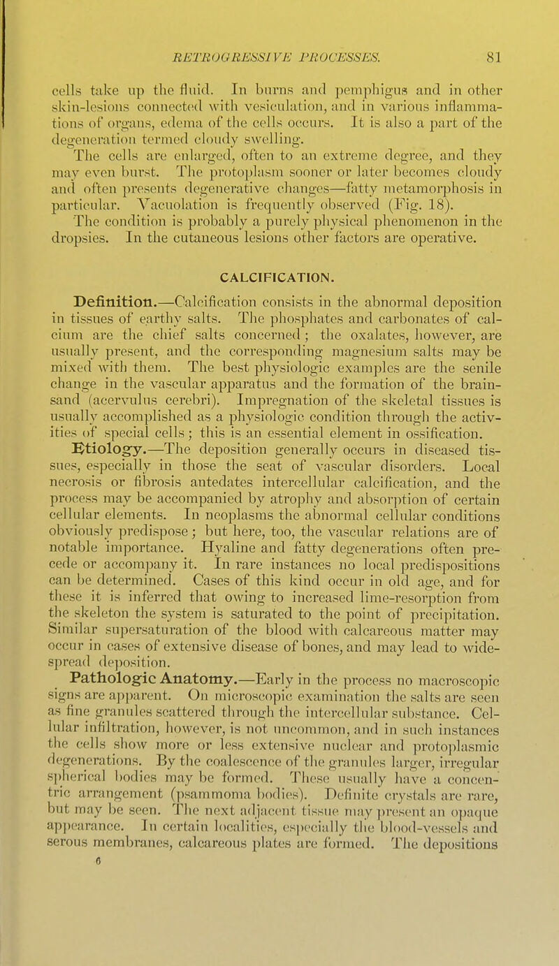 cells take up tiio fluid. In burns find pemphigus and in other skin-lesions connectcnl with vesiculation, and in various inflamma- tions of organs, edema of the cells occurs. It is also a part of the degeneration termed cloudy swelling. The cells are enlarged, often to an extreme degree, and they may even burst. The protoplasm sooner or later becomes cloudy and often presents degenerative changes—fatty metamorphosis in particular. Vacuolation is frequently observed (Fig. 18). The condition is probably a purely physical phenomenon in the dropsies. In the cutaneous lesions other factors are operative. CALCIFICATION. Definition.—Calcification consists in the abnormal deposition in tissues of earthy salts. The phosphates and carbonates of cal- cium are the chief salts concerned; the oxalates, however, are usually present, and the corresponding magnesium salts may be mixed with them. The best physiologic examples are the senile change in the vascular apj^aratus and the formation of the brain- sand (acervulus cerebri). Impregnation of the skeletal tissues is usually accomplished as a physiologic condition througli the activ- ities of special cells; this is an essential element in ossification. i^tiology.—The deposition generally occurs in diseased tis- sues, especially in those the seat of vascular disorders. Local necrosis or fibrosis antedates intercellular calcification, and the process may be accompanied by atrophy and absorption of certain cellular elements. In neoplasms the abnormal cellular conditions obviously predispose; but here, too, the vascular relations are of notable importance. Hyaline and fatty degenerations often pre- cede or accompany it. In rare instances no local predispositions can be determined. Cases of this kind occur in old age, and for these it is inferred that owing to increased lime-resorption from the skeleton the system is saturated to the point of precipitation. Similar snpersaturation of the blood with calcareous matter may occur in cases of extensive disease of bones, and may lead to wide- spread de])osition. Pathologic Anatomy.—Early in the process no macroscopic signs are apparent. On microscopic examination the salts are seen as fine granules scattered through the intei'cellular substance. Cel- lular infiltration, however, is not imcommon, and in such instances the cells show more or less extensive nuclear and protoplasmic degenerations. By the coalescence of the granules larger, irregular spherical bodies may be formed. These usually have a concen- tric arrangement (psammoma bodies). Definite crystals are rare, but may be seen. The next adjacent tissue may ])resent an opaque appearance. In certain localities, especially tlie blood-vessels and serous membranes, calcareous plates are formed. The depositions 8