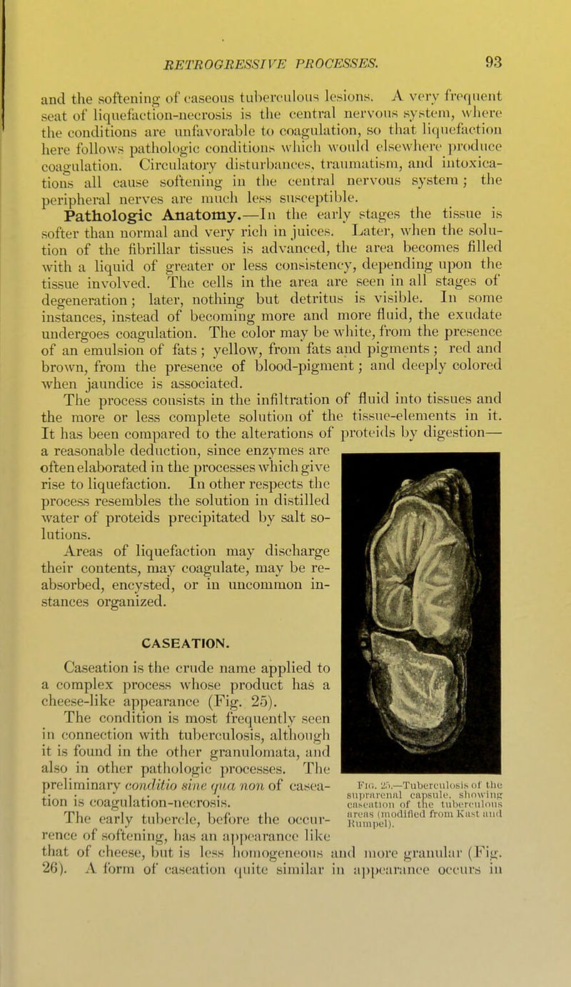 and the softening of caseous tuberculous lesions. A very frequent seat of liquefaction-necrosis is the central nervous system, where the conditions are unfavorable to coagulation, so that liquefaction here follows pathologic conditions which would elsewhere produce coagulation. Circulatory disturbances, traumatism, and intoxica- tions all cause softening in the central nervous system; the peripheral nerves are much less susceptible. Pathologic Anatomy.—In the early stages the tissue is softer than normal and very rich in juices. Later, when the solu- tion of the fibrillar tissues is advanced, the area becomes filled with a liquid of greater or less consistency, depending upon the tissue involved. The cells in the area are seen in all stages of degeneration; later, nothing but detritus is visible. In some instances, instead of becoming more and more fluid, the exudate undergoes coagulation. The color may be white, from the presence of an emulsion of fats ; yellow, from fats and pigments ; red and brown, from the presence of blood-pigment; and deeply colored when jaundice is associated. The process consists in the infiltration of fluid into tissues and the more or less complete solution of the tissue-elements in it. It has been compared to the alterations of proteids by digestion— a reasonable deduction, since enzymes are often elaborated in the processes which give rise to liquefaction. In other respects the process resembles the solution in distilled water of proteids precipitated by salt so- lutions. Areas of liquefaction may discharge their contents, may coagulate, may be re- absorbed, encysted, or in uncommon in- stances organized. CASEATION. Caseation is the crude name applied to a complex process Avhose product has a cheese-like appearance (Fig. 25). The condition is most frequently seen in connection with tuberculosis, although it is found in the other granulomata, and also in other pathologic processes. The preliminary conditio sine (lua non of casea- vu-,. 'jr).—TubercuiosiN oi the • ' 1 • snpnirenul capsule, showing tlOn IS coagulation-necrosis. cnseiition of the mberculous The early tubercle, before the occur- '>/;;';;«^ojy.difledfromKa.tu,ui rence of softening, has an appearance like that of cheese, but is less homogeneous and more granular (Fig. 26). A form of caseation (piite similar in a])pearance occurs in