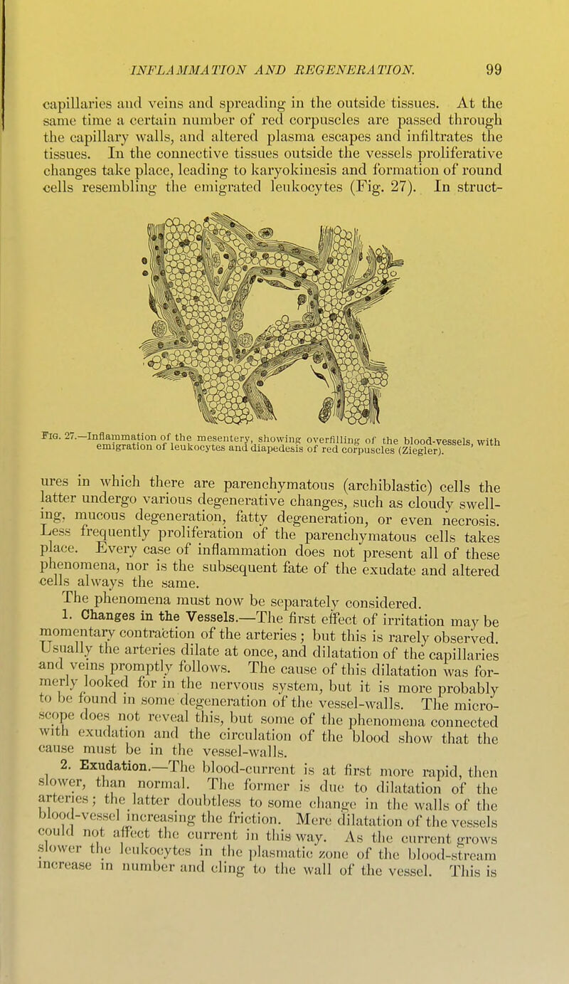 capillaries aud veins and spreading in the outside tissues. At the same time a certain number of red corpuscles are passed through the capillary walls, and altered plasma escapes and inliltrates the tissues. In the connective tissues outside the vessels proliferative changes take place, leading to karyokinesis and formation of round cells resembling the emigrated leukocytes (Fig. 27). In struct- iflammation of the mesentery, showiiiK overfilling of the blood-vessels with emigration of leukocytes and diapedesis of red corpuscles (Ziegler) ures m which there are parenchymatous (archiblastic) cells the latter undergo various degenerative changes, such as cloudy swell- mg, mucous degeneration, fatty degeneration, or even necrosis. Less frequently proliferation of the parenchymatous cells takes place. Every case of inflammation does not jjresent all of these phenomena, nor is the subsequent fate of the exudate and altered cells always the same. The phenomena must now be separately considered. 1. Changes in the Vessels.—The first effect of irritation may be momentary contraction of the arteries; but this is rarely observed Usually the arteries dilate at once, and dilatation of the capillaries and vems promptly follows. The cause of this dilatation was for- merly looked for in the nervous system, but it is more probably to be found in some degeneration of the vessel-walls. The micro- scope does not H'veal this, but some of the phenomena connected with exudation and the circulation of the blood show that the cause must be m the vessel-walls. 2. Exudation.—The blood-current is at first more rapid, then slower, than normal. The former is due to dilatation of the arteries; the latter doubtless to some change in the walls of the blood-vessel increasing the friction. Mere dilatation of the vessels could not affect the current in this way. As the current grows •slower tfie leukocytes in the i)lasmatic zone of the blood-stream increase in number and cling to the wall of the vessel. This is