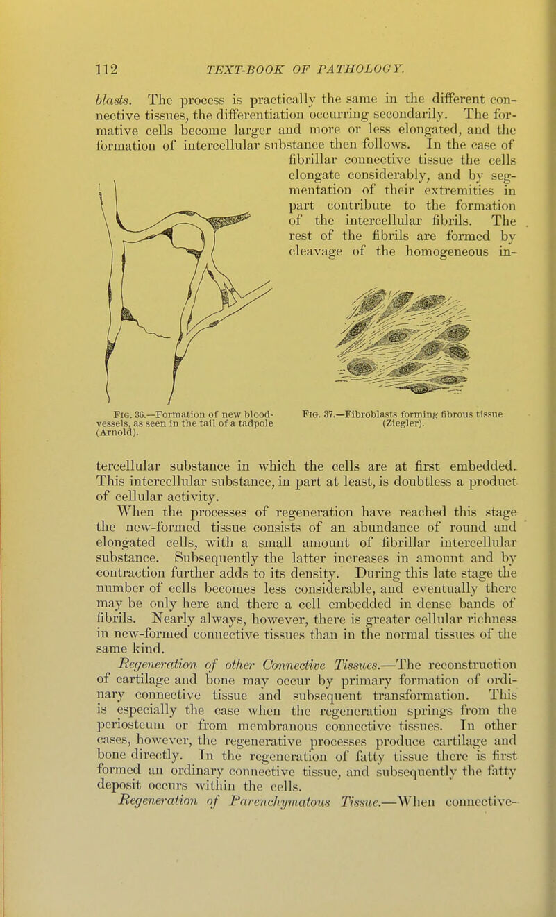 blasts. The process is practically the same in the diiferent con- nective tissues, the diiFerentiation occurring secondarily. The for- mative cells become larger and more or less elongated, and the formation of intercellular substance then follows. In the case of fibrillar connective tissue the cells elongate considerably, and by seg- mentation of their extremities in part contribute to the formation of the intercellular fibrils. The rest of the fibrils are formed by cleavage of the homogeneous in- FiG. 36.—Formation of new blood- vessels, as seen in the tail of a tadpole (Arnold). Fig. 37.—Fibroblasts forming fibrous tissue (Ziegler). tercellular substance in Avhich the cells are at first embedded. This intercellular substance, in part at least, is doubtless a product of cellular activity. When the processes of regeneration have reached this stage the new-formed tissue consists of an abundance of round and elongated cells, with a small amount of fibrillar intercellular substance. Subsequently the latter increases in amount and by contraction further adds to its density. During this late stage the number of cells becomes less considerable, and eventually there may be only here and there a cell embedded in dense bands of fibrils. Nearly always, however, there is greater cellular richness in new-formed connective tissues than in the normal tissues of the same kind. Regeneration of other Connective Tissues.—The reconstruction of cartilage and bone may occur by primary formation of ordi- nary connective tissue and subsequent transformation. This is especially the case Avhen the regeneration springs from the periosteum or from membranous connective tissues. In other cases, however, the regenerative processes produce cartilage and bone directly. In the regeneration of fatty tissue there is first formed an ordinary connective tissue, and subsequently the fatty deposit occurs within the cells. Regeneration of Parenchymatous Tissue.—When connective-