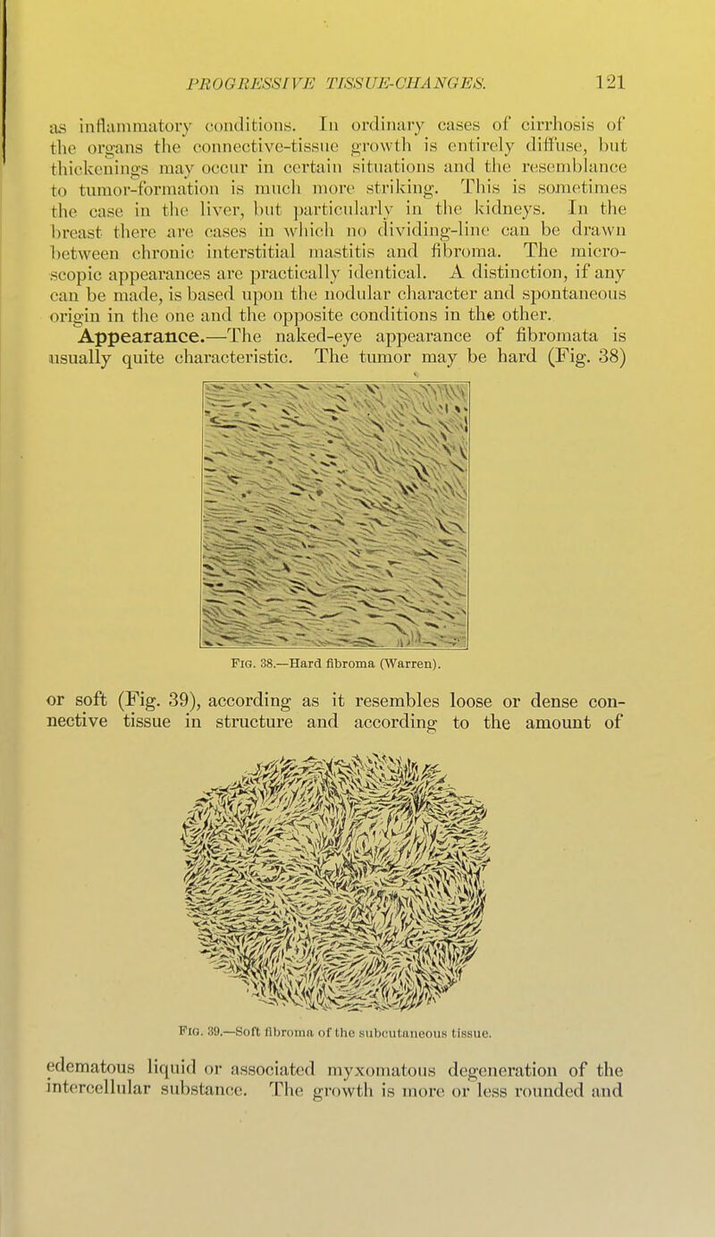 as influnimatory conditions. In ordinary cases of cirrhosis of the organs tlie connective-tissne growth is entirely diffuse, but thickenings may occur in certain situations and the resenibkmce to tumor-formation is much more striking. This is sometimes the case in tlie liver, but ])articularly in the kidneys. In the breast there are cases in wliicih no (lividing-line can be di-awn between chi'onic interstitial mastitis and fibroma. The micro- scopic appearances are practically identical. A distinction, if any can be made, is based upon the nodular character and spontaneous origin in the one and the opposite conditions in the other. Appearance.—The naked-eye appearance of fibromata is usually quite characteristic. The tumor may be hard (Fig. 38) Fig. 38.—Hard fibroma (Warren). or soft (Fig. 39), according as it resembles loose or dense con- nective tissue in structure and according to the amount of Fio. 39.—Soft fibroinn of the subcutaneous tissue. edematous liquid or associated myxomatous degeneration of the intercellular substance. The growth is more or less rounded and