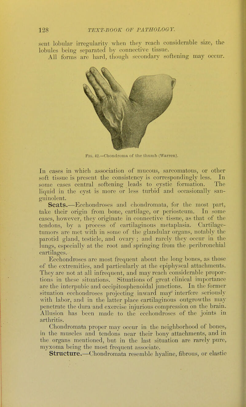 sent lobular irregularity when they reach considerable size, the lobules being separated by connective tissue. All forms are hard, thougli secondary softening may occur. Fig. 42.—Chondroma of the thumb (Warren). In cases in which association of mucous, sarcomatous, or other soft tissue is present the consistency is correspondingly less. In some cases central softening leads to cystic formation. The liquid in the cyst is more or less turbid and occasionally san- guinolent. Seats.—Ecchondroses and chondromata, for the most part, take their origin from bone, cartilage, or j^eriosteum. In some cases, however, they originate in connective tissue, as that of the tendons, by a process of cartilaginous metaplasia. Cartilage- tumors are met with in some of the glandular organs, notably the parotid gland, testicle, and ovary ; and rarely they occur in the lungs, especially at the root and .springing from the peribronchial cartilages. Ecchondroses are most frequent about the long bones, as those of the extremities, and particularly at the epiphyseal attachments. They are not at all infrequent, and may reach considei'able pi'opor- tions in these situations. Situations of great clinical importance are the interpubic and occipitosphenoidal junctions. In the former situation ecchondroses projecting inward may interfere seriously with labor, and in the latter place cartilaginous outgrowths may ])enetrate the dura and exercise injurious compression on the bi*ain. Allusion has been made to the ecchondroses of the joints in arthritis. Chondromata proper may occur in the neighborhood of bones, in the muscles and tendons near their bony attachments, and in the organs mentioned, but in the last situation are rarely pure, myxoma being the most frequent associate. Structure.—Chondromata resemble hyaline, fibrous, or elastic