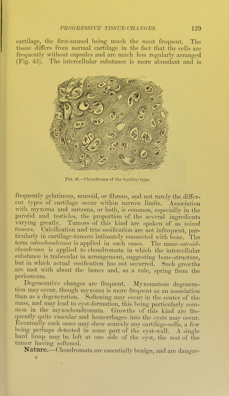 cartilage, the first-named being mnch the most frequent. The tissue differs from normal cartilage in the fact that the cells are frequently without capsules and are much less regularly arranged (Fig. 43). The intercellular substance is more abundant and is Fig. 43.—Chondroma of the hyaline type. frequently gelatinous, mucoid, or fibrous, and not rarely the differ- ent types of cartilage occur within narrow limits. Association with myxoma and sarcoma, or both, is common, especially in the parotid and testicles, the proportion of the several ingredients varying greatly. Tumors of this kind are spoken of as mixed tumors. Calcification and true ossification are not infrequent, par- ticularly in cartilage-tumors intimately connected Avith bone. The term osteochondroma is applied in such cases. The n^awe osteoid- chondroma is applied to chondromata in which the intercellular substance is trabecular in arrangement, suggesting bone-structure, but in which actual ossification has not occurred. Such growths are_ met with about the bones and, as a rule, spring from the periosteum. Degenerative changes are frequent. Myxomatous degenera- tion may occur, though myxoma is more frequent as an association than as a degeneration. Softening may occur in the center of the mass, and may lead to cyst-formation, this being particularly com- mon in the myxochondromata. Growths of this kind are fre- (piently quite vascular and hemorrhages into the cysts may occur. Eventually such cases may show scarcely any cartilage-cells, a few bei ng p(!rliaps detected in some part of the cyst-wall. A single hard hnnp may be left at one side of the cyst, the rest of the tumor having softened. Nature.—Chondromata are essentially benign, and are danger-