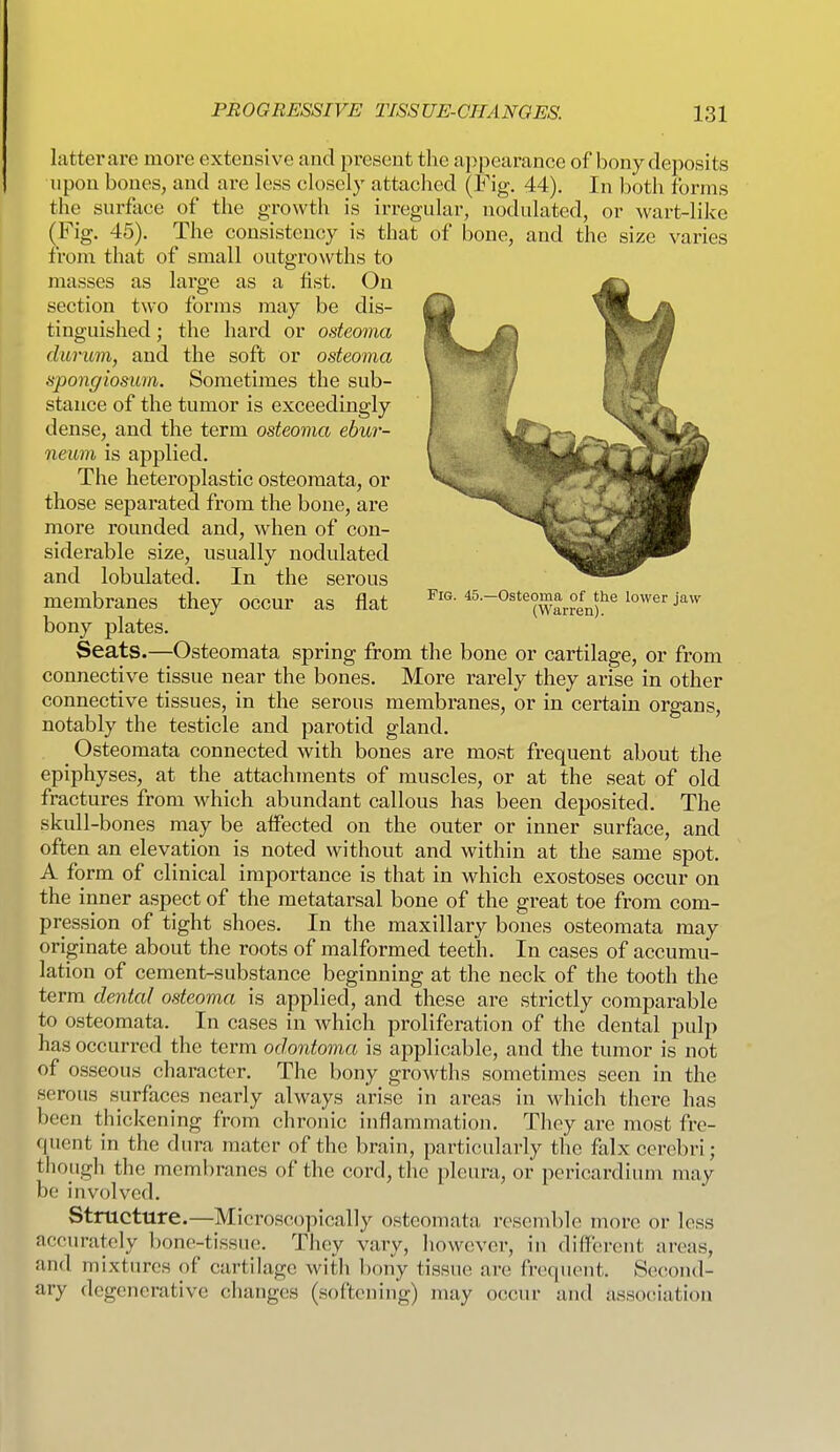 latter are more extensive and present the appearance of bony deposits upon bones, and are less closely attached (Fig. 44). In both forms the surface of the growth is irregular, nodulated, or wart-like (Fig. 45). The consistency is that of bone, and the size varies from that of small outgrowths to masses as large as a fist. On section two forms may be dis- tinguished ; the hard or osteoma durum, and the soft or osteoma spongiosum. Sometimes the sub- stance of the tumor is exceedingly dense, and the term osteoma ebur- neum is applied. The heteroplastic osteoraata, or those separated from the bone, are more rounded and, when of con- siderable size, usually nodulated and lobulated. In the serous membranes they occur as flat fig. 45.-osteoma^of^the lower jaw bony plates. Seats.—Osteomata spring from the bone or cartilage, or from connective tissue near the bones. More rarely they arise in other connective tissues, in the serous membranes, or in certain organs, notably the testicle and parotid gland. Osteomata connected with bones are most frequent about the epiphyses, at the attachments of muscles, or at the seat of old fractures from which abundant callous has been deposited. The skull-bones may be affected on the outer or inner surface, and often an elevation is noted without and within at the same spot. A form of clinical importance is that in which exostoses occur on the inner aspect of the metatarsal bone of the great toe from com- pression of tight shoes. In the maxillary bones osteomata may originate about the roots of malformed teeth. In cases of accumu- lation of cement-substance beginning at the neck of the tooth the term dental osteoma is applied, and these are strictly comparable to osteomata. In cases in which proliferation of the dental pulp has occurred the term odontoma is applicable, and the tumor is not of osseous character. The bony growths sometimes seen in the serous surfaces nearly always arise in areas in which there has been thickening from chronic inflammation. They are most fre- quent in the dura mater of the brain, particularly the falx cerebri; though the membranes of the cord, the pleura, or pericardium may be involved. Structure.—Microscopically osteomata resemble more or less accurately bone-tissue. They vary, however, in diflferent areas, and mixtures of cartilage with bony tissue are fn^ciuent. Seciond- ary degenerative changes (softening) may occur and association