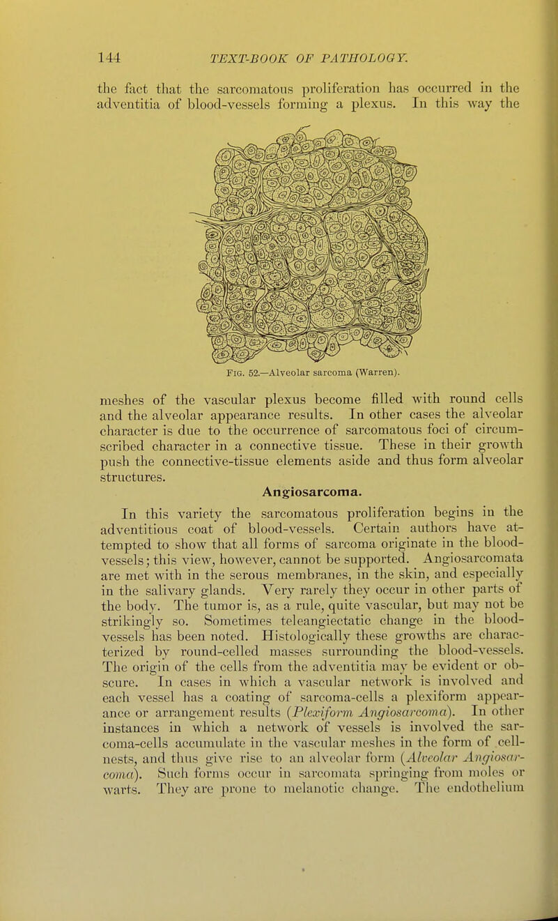 the fact that the sarcomatous proliferation has occurred in the adventitia of blood-vessels forming a plexus. In this way the Fig. 52.—Alveolar sarcoma (Warren). meshes of the vascular plexus become filled with round cells and the alveolar appearance results. In other cases the alveolar character is due to the occurrence of sarcomatous foci of circum- scribed character in a connective tissue. These in their growth push the connective-tissue elements aside and thus form alveolar structures. Angiosarcoma. In this variety the sarcomatous proliferation begins in the adventitious coat of blood-vessels. Certain authors have at- tempted to show that all forms of sarcoma originate in the blood- vessels; this view, however, cannot be supported. Angiosarcomata are met with in the serous membranes, in the skin, and especially in the salivary glands. Very rarely they occur in other parts of the body. The tumor is, as a rule, quite vascular, but may not be strikingly so. Sometimes teleangiectatic change in the blood- vessels has been noted. Histologically these growths are charac- terized by round-celled masses surrounding the blood-vessels. The origin of the cells from the adventitia may be evident or ob- scure. In cases in which a vascular network is involved and each vessel has a coating of sarcoma-cells a plexiform appear- ance or arrangement results {Plexiform Angiosarcoma). In other instances in which a network of vessels is involved the sar- coma-cells accumulate in the vascular meshes in the form of .cell- nests, and thus give rise to an alveolar form {Alveolar Angiosar- coma). Such forms occur in sarcomata springing from moles or warts. They are prone to melanotic change. The endothelium