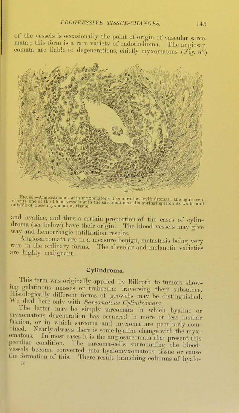of the vessels is occasionally the point of origin of vascular sarco- mata ; this form is a rare variety of endothelioma. The angiosar- comata are liable to degenerations, chiefly myxomatous (Fig. 53) 4f i / resenK'^rn^f^th'p^w^^i?^'''!' de.aroneratinn (nylindroma) : the figure rep- omsidl o7?he^e my^matotflfissul' sarcomatous cells springing from its wills, a.fd and hyaline, and thus a certain proportion of the cases of cylin- droma (see below) have their origin. Tiie blood-vessels may give Avay and hemorrhagic infiltration results. Angiosarcomata are in a measure benign, metastasis being very rare in the ordinary forms. The alveolar and melanotic varieties are highly malignant. Cylindroma. _ This term was originally applied by Billroth to tumors show- ing gelatinous masses or trabecule traversing their substance. Histologically different forms of growths may be distinguished. \\ e^ deal here only with Sarcomatous Otjlmdroniata. The latter may be simply sarcomata in which hyaline or myxomatous degeneration has occurred in more or less insular fashion, or in which sarcoma and myxoma are peculiarly com- bined. Nearly always there is some hyaline change with the myx- omatous. In most cases it is the angiosarcomata that present this peculiar condition. The sarcoma-cells surrounding the blood- vessels become converted into hyalomyxomatous tissue or cause the ff)rmation of this. There result branching columns of hyalo-