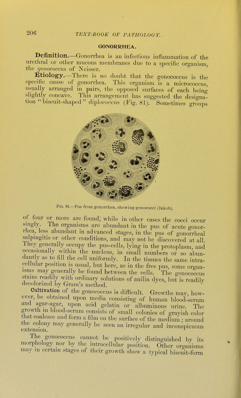 GONORRHEA. Definition.—Gonorrhea is an infectious inflammation of the urethral or other mucous membranes due to a specific organism, tlie gonoGoccus of Neisser. ' :^tiology.—There is no doubt that the gonococcus is the specific cause of gonorrhea. This organism is a micrococcus, usually arranged in pairs, the opposed surfaces of each being slightly concave. This arrangement has suggested the designa- tion  biscuit-shaped  diplococcus (Fig. 81). Sometimes groups Fig. 81—Pus from gonorrhea, showing gonococci (Jakob). of four or more are found; while in other cases the cocci occur singly Ihe organisms are abundant in the pus of acute gonor- rhea, less abundant in advanced stages, in the pus of gonorrheal salpingitis or other conditions, and may not be discovered at all 1 hey generally occupy the pus-cells, lying in the protoplasm, and occasionally within the nucleus, in small numbers or so abun- dantly as to fill the cell uniformly. In the tissues the same intra- cellular position is usual, but here, as in the free pus, some organ- isms may generally be found between the cells. The gonococcus stains readily with ordinary solutions of anilin dyes, but is readily decolorized by Gram's method. Cultivation of the gonococcus is difficult. Growths may, how- ever, be obtained upon media consisting of human blood-serum and agar-agar, upon acid gelatin or albuminous urine. The growth in blood-s^rum consists of small colonies of grayish color that coalesce and form a film on the surflice of the medkim : around extension^ '^ g«°erally be seen an irregular and inconspicuous The gonococcus cannot be positively distinguished by its morphology nor by the intracellular position. Other organisms may in certain stages of their growth show a typical biscuit-form
