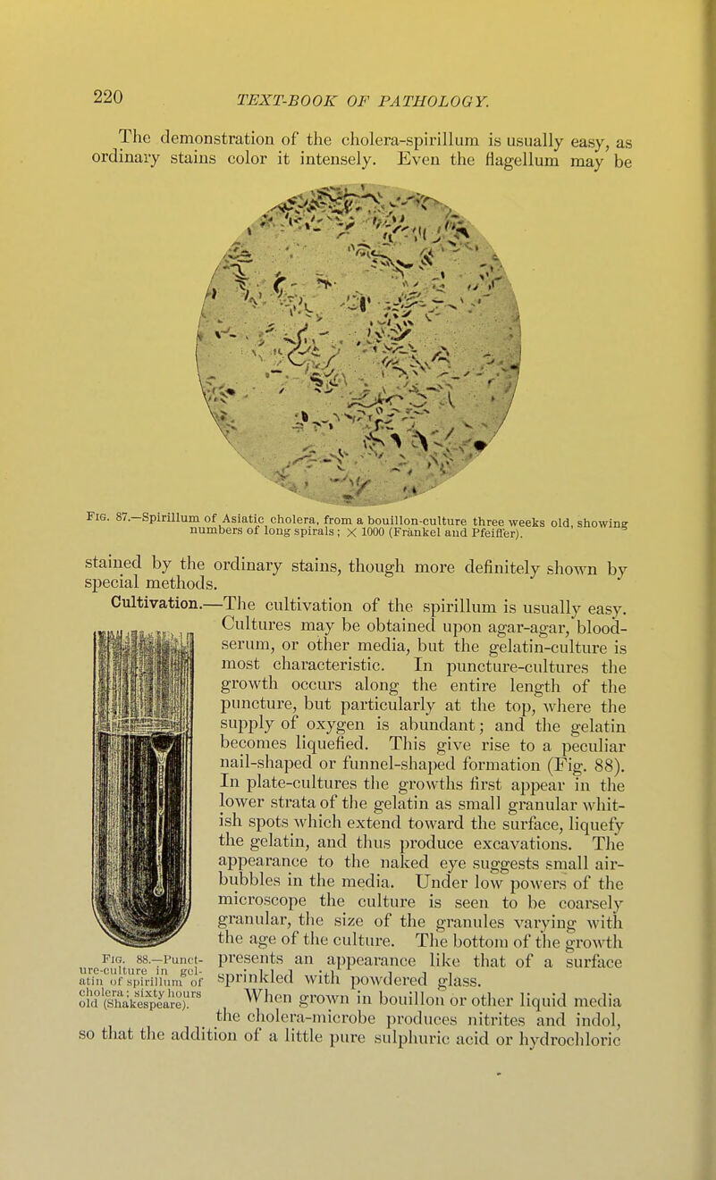The demonstration of the cholera-spirillum is usually easy, as ordinary stains color it intensely. Even the fiagellum may be > 'S.lri ... ^x-f. sr. ■ Fis. 87—Spirillum of Asiatic cholera, from a bouillon-culture three weeks old shovvin? numbers of long spirals; X 1000 (Frankel and Pfeifler). ' stained by the ordinary stains, though more definitely shown by special methods. Cultivation.—The cultivation of the spirillum is usually easy. Cultures may be obtained upon agar-agar, blood- serum, or other media, but the gelatin-culture is most characteristic. In puncture-cultures the growth occurs along the entire length of the puncture, but particularly at the top, where the supply of oxygen is abundant; and the gelatin becomes liquefied. This give rise to a peculiar nail-shaped or funnel-shaped formation (Fig. 88). In plate-cultures tlie growths first appear in the lower strata of the gelatin as small granular whit- ish spots which extend toward the surface, liquefy the gelatin, and thus produce excavations. The appearance to the naked eye suggests small air- bubbles in the media. Under low powers of the microscope the culture is seen to be coarsely granular, the size of the granules varying with the age of the culture. The bottom of tlie growth presents an appearance like that of a surface sprinkled with powdered glass. When grown in bouillon or other liquid media the cholera-microbe produces nitrites and indol, so that the addition of a little pure sulphuric acid or hydrochloric Fio. 88.—Punct- uro-cull-ure in gel- atin of spirillum of cholera; sixty hours old (Shakespeare).