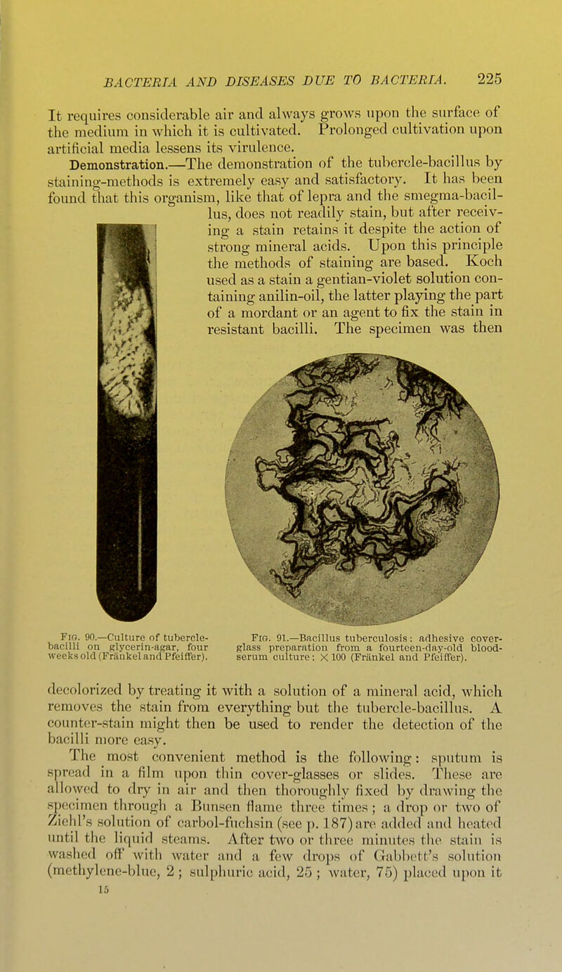 It requires considerable air and always grows upon the surface of the medium in which it is cultivated. Prolonged cultivation upon artificial media lessens its virulence. Demonstration.—The demonstration of the tubercle-bacillus by staining-methods is extremely easy and satisfactory. It has been found that this organism, like that of lepra and the smegma-bacil- lus, does not readily stain, but after receiv- ing a stain retains it despite the action of strong mineral acids. Upon this principle the methods of staining are based. Koch used as a stain a gentian-violet solution con- taining anilin-oil, the latter playing the part ' \f I of a mordant or an agent to fix the stain in '■'i/- ^ resistant bacilli. The specimen was then Fig. 90.—Culture of tubercle- Fig. 91.—Bacillus tuberculosis: arlhesive cover- bacilli on fflycerin-agar, four glass preparation from a fourtcen-dny-old blood- weeks old (Frankel and Pfeiffer). serum culture; X 100 (Frankel and Pfeiffer). decolorized by treating it with a solution of a mineral acid, which removes the stain from everything but the tubercle-bacillus. A counter-stain might then be used to render the detection of the bacilli more easy. The most convenient method is the following: sputum is spread in a film upon tliin cover-glasses or slides. These are allowed to dry in air and then thoroughly fixed by drawing the .specimen through a Bunsen flame three times; a drop oi- two of Ziehl's solution of carbol-fuchsin (see p. 187) are added and heated until the liquid steams. After two or three minutes the stain is washed off with water juid a few drops of Gabbett's solution (methylene-blue, 2; sulphuric acid, 25 ; water, 75) placed upon it 15