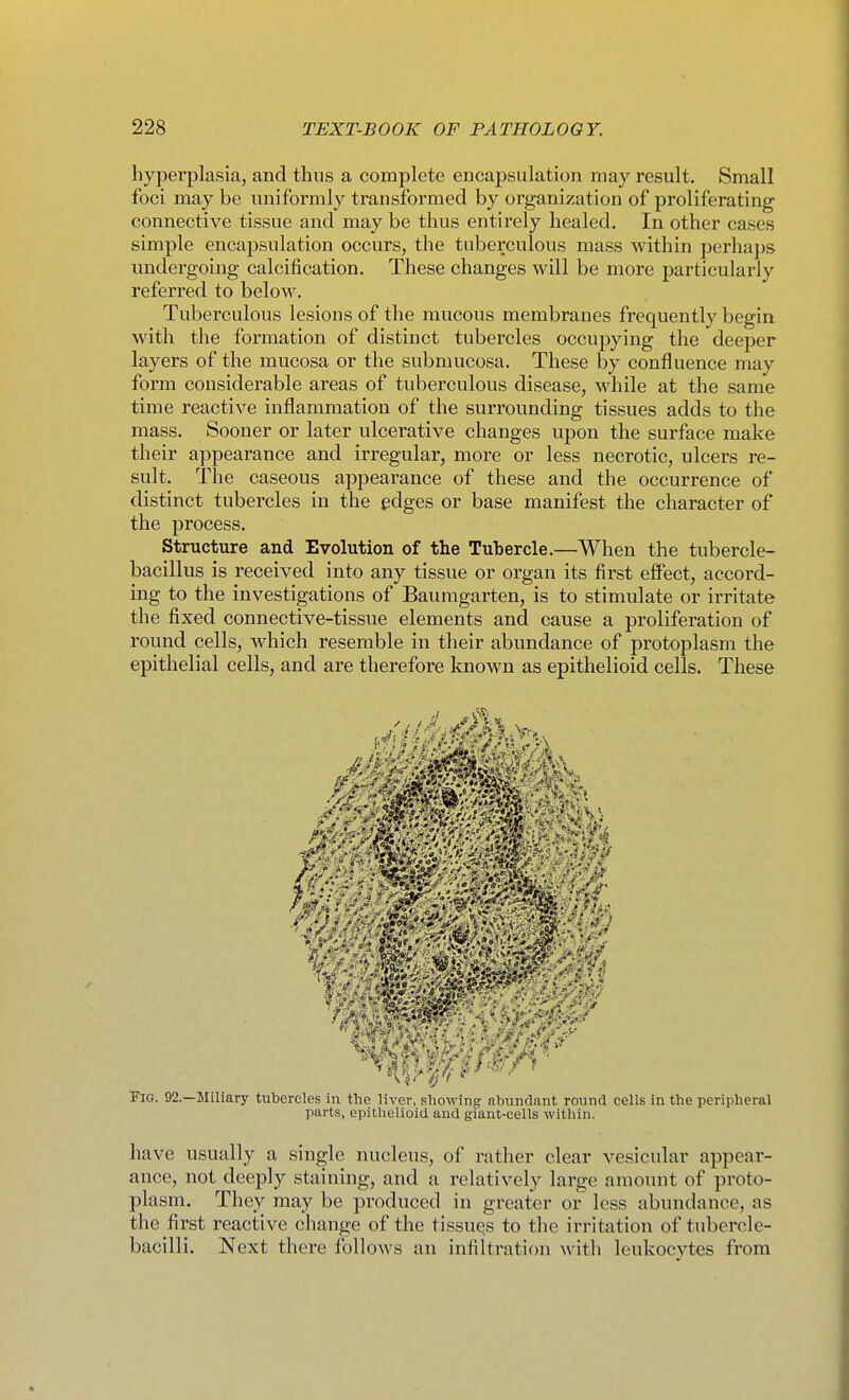 hyperplasia, and thus a complete encapsulation may result. Small foci may be uniformly transformed by organization of proliferating connective tissue and may be thus entirely healed. In other cases simple encapsulation occurs, the tuberculous mass within perhaps undergoing calcification. These changes will be more particularly referred to below. Tuberculous lesions of the mucous membranes frequently begin with the formation of distinct tubercles occupying the deeper layers of the mucosa or the submucosa. These by confluence may form considerable areas of tuberculous disease, while at the same time reactive inflammation of the surrounding tissues adds to the mass. Sooner or later ulcerative changes upon the surface make their appearance and irregular, more or less necrotic, ulcers re- sult. The caseous appearance of these and the occurrence of distinct tubei'cles in the edges or base manifest the character of the process. Structure and Evolution of the Tubercle.—When the tubercle- bacillus is received into any tissue or organ its first effect, accord- ing to the investigations of Baumgarten, is to stimulate or irritate the fixed connective-tissue elements and cause a proliferation of round cells, which resemble in their abundance of protoplasm the epithelial cells, and are therefore known as epithelioid cells. These Iff * * x. * ' ^ « h K' ';4'''*^ ^ ft Fig. 92.—Miliary tubercles in the liver, showint? nbund.ant round cells in the peripheral parts, epithelioid and giant-cells within. liave usually a single nucleus, of rather clear vesicular appear- ance, not deeply staining, and a relatively large amount of proto- plasm. They may be produced in greater or less abundance, as the first reactive change of the tissues to the irritation of tubercle- bacilli. Next there follows an infiltrati(m with leukocytes from