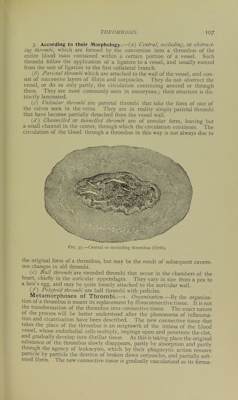 3. According to their Morphology.—(a) Central, occluding, or obstruct- ing thrombi, which are formed by the conversion into a thrombus of the entire blood mass contained within a certain portion of a vessel. Such thrombi follow the application of a ligature to a vessel, and usually extend from the seat of ligation to the first collateral branch. (b) Parietal thrombi which are attached to the wall of the vessel, and con- sist of successive layers of fibrin and corpuscles. They do not obstruct the vessel, or do so only partly, the circulation continuing around or through them. They are most commonly seen in aneurysilis; their structure is dis- tinctly laminated. (c) Valvular thrombi are parietal thrombi that take the form of one of the valves seen in the veins. They are in reality simply parietal thrombi that have become partially detached from the vessel wall. (d) Channelled or tunnelled thrombi are of annular form, leaving but a small channel in the center, through which the circulation continues. The circulation of the blood through a thrombus in this way is not always due to Fig. 35.—Central or occluding thrombus (Orth). the original form of a thrombus, but may be the result of subsequent cavern- ous changes in old thrombi. (<?) Ball thrombi are rounded thrombi that occur in the chambers of the heart,, chiefly in the auricular appendages. They vary in size from a pea to a hen’s egg, and may be quite loosely attached to the auricular wall. C/) Polypoid thrombi are ball thrombi with pedicles. Metamorphoses of Thrombi.—1. Organization.—By the organiza- tion of a thrombus is meant its replacement by fibroconnective tissue. It is not the transformation of the thrombus into connective tissue. The exact nature of the process will be better understood after the phenomena of inflamma- tion and cicatrization have been described. The new connective tissue that takes the place of the thrombus is an outgrowth of the intima of the blood vessel, whose endothelial cells multiply, impinge upon and penetrate the clot, and gradually develop into fibrillar tissue. As this is taking place the original substance of the thrombus slowly disappears, partly by absorption and partly through the agency of leukocytes, which by their phagocytic action remove particle by particle the detritus of broken down corpuscles, and partially soft- ened fibrin. The new connective tissue is gradually vascularized as its forma-