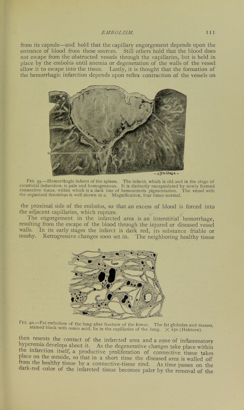 from its capsule—and hold that the capillary engorgement depends upon the entrance of blood from these sources. Still others hold that the blood does not escape from the obstructed vessels through the capillaries, but is held in place by the embolus until anemia or degeneration of the walls of the vessel allow it to escape into the tissue. Lastly, it is thought that the formation of the hemorrhagic infarction depends upon reflex contraction of the vessels on Fig 39.—Hemorrhagic infarct of the spleen. The infarct, which is old and in the stage of cicatricial induration, is pale and homogeneous. It is distinctly encapsulated by newly formed connective tissue, within which is a dark line of hemosiderin pigmentation. The vessel with the organized thrombus is well shown at a. Magnification, four times normal. the proximal side of the embolus, so that an excess of blood is forced into the adjacent capillaries, which rupture. The engorgement in the infarcted area is an interstitial hemorrhage, resulting from the escape of the blood through the injured or diseased vessel walls. In its early stages the infarct is dark red, its substance friable or mushy. Retrogressive changes soon set in. The neighboring healthy tissue Fm. 40. Fat embolism of the lung after fracture of the femur. The fat globules and masses, stained black with osmic acid, lie in the capillaries of the lung. X 150 (Hektoen). then resents the contact of the infarcted area and a zone of inflammatory yperemia develops about it. As the degenerative changes take place within the infarction itself, a productive proliferation of connective tissue takes place on the outside, so that in a short time the diseased area is walled off from the healthy tissue by a connective-tissue rind. As time passes on the dark-red color of the infarcted tissue becomes paler by the removal of the