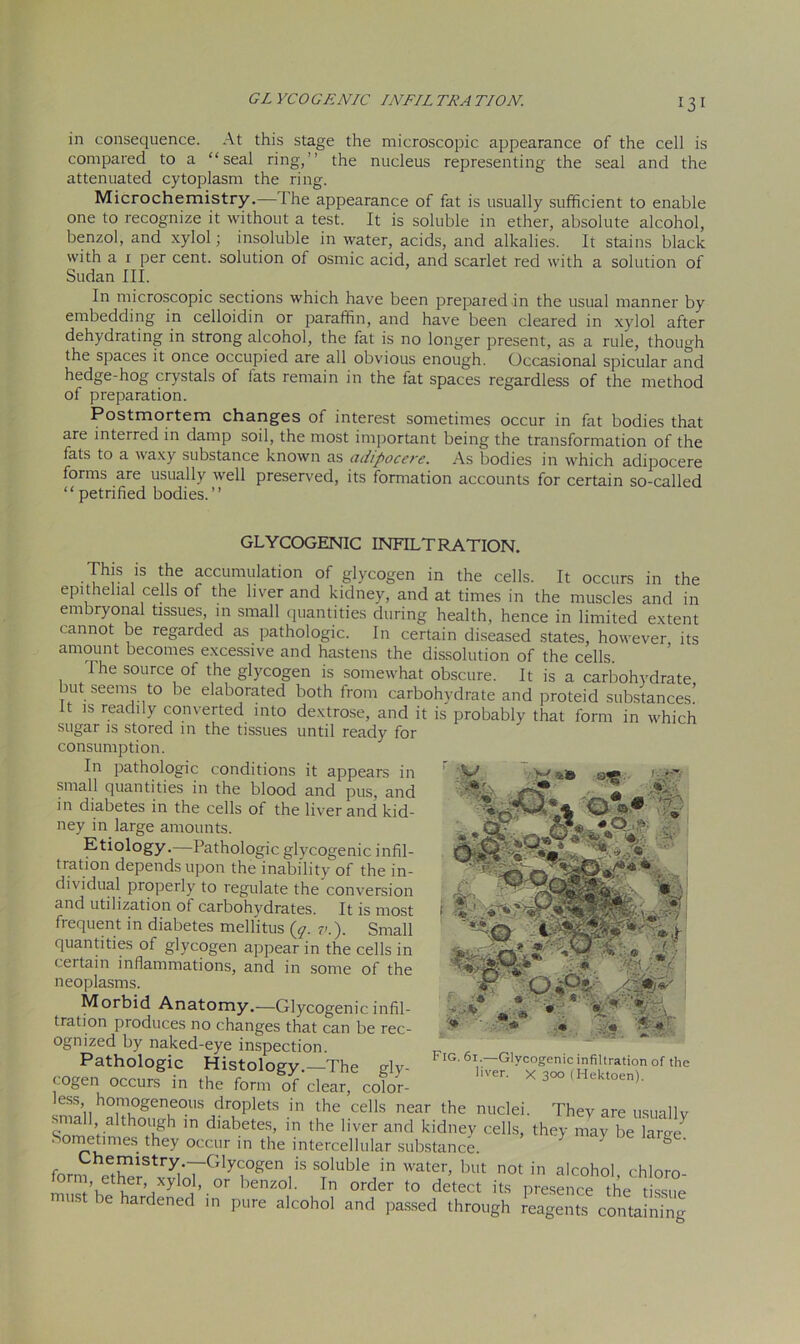 GL YCO GENIC INFIL TKA TION. in consequence. At this stage the microscopic appearance of the cell is compared to a “seal ring,” the nucleus representing the seal and the attenuated cytoplasm the ring. Microchemistry.— The appearance of fat is usually sufficient to enable one to recognize it without a test. It is soluble in ether, absolute alcohol, benzol, and xylol; insoluble in water, acids, and alkalies. It stains black with a 1 per cent, solution of osmic acid, and scarlet red with a solution of Sudan III. In microscopic sections which have been prepared in the usual manner by embedding in celloidin or paraffin, and have been cleared in xylol after dehydrating in strong alcohol, the fat is no longer present, as a rule, though the spaces it once occupied are all obvious enough. Occasional spicular and hedge-hog crystals of fats remain in the fat spaces regardless of the method of preparation. Postmortem changes of interest sometimes occur in fat bodies that are interred in damp soil, the most important being the transformation of the fats to a waxy substance known as adipocere. As bodies in which adipocere forms are usually well preserved, its formation accounts for certain so-called “ petrified bodies.” GLYCOGENIC INFILTRATION. This is the accumulation of glycogen in the cells. It occurs in the epithelial cells of the liver and kidney, and at times in the muscles and in embryonal tissues, in small quantities during health, hence in limited extent cannot be regarded as pathologic. In certain diseased states, however its amount becomes excessive and hastens the dissolution of the cells. The source of the glycogen is somewhat obscure. It is a carbohydrate ut seems to be elaborated both from carbohydrate and proteid substances! it is readily converted into dextrose, and it is probably that form in which sugar is stored in the tissues until ready for consumption. In pathologic conditions it appears in small quantities in the blood and pus, and in diabetes in the cells of the liver and kid- ney in large amounts. Etiology.—Pathologic glycogenic infil- tration depends upon the inability of the in- dividual properly to regulate the conversion and utilization of carbohydrates. It is most frequent in diabetes mellitus (y. v.). Small quantities of glycogen appear in the cells in ceitain inflammations, and in some of the neoplasms. Morbid Anatomy.—Glycogenic infil- tration produces no changes that can be rec- ognized by naked-eye inspection. Pathologic Histology.—The gly- cogen occurs in the form of clear, color- ess homogeneous droplets in the cells near the nuclei. They are usuallv small although in diabetes, in the liver and kidney cells, they may be lame Sometimes they occur in the intercellular substance. ? 0 forni eetSrStv^'o7GlyCK°gen,iS s°luble> water> bat not in alcohol, chloro- , ether xylol, 0r benzol. In order to detect its presence the tissue must be hardened in pure alcohol and passed through reagents containing O.iR*; • - * * '* Fig. 61.—Glycogenic infiltration of the liver, x 30° (Hektoen).