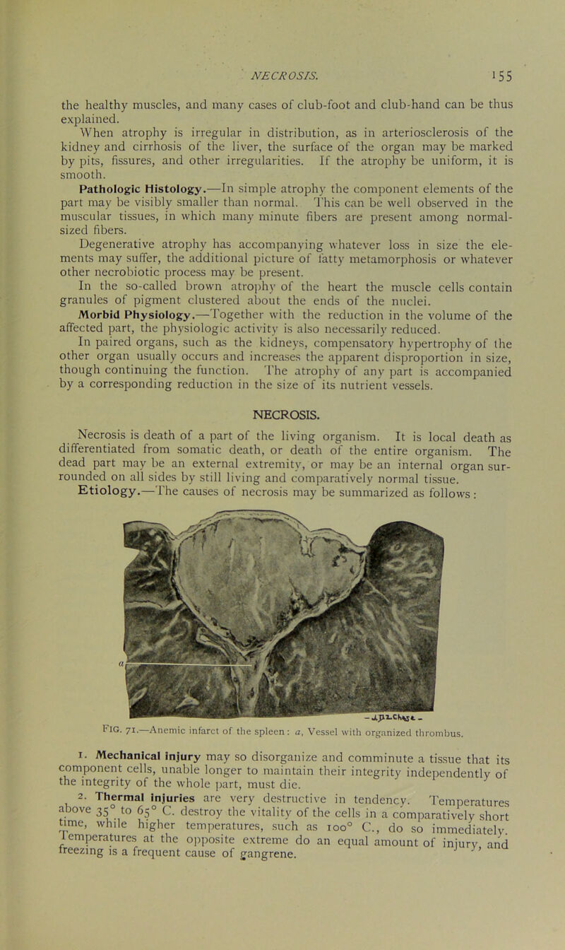 the healthy muscles, and many cases of club-foot and club-hand can be thus explained. When atrophy is irregular in distribution, as in arteriosclerosis of the kidney and cirrhosis of the liver, the surface of the organ may be marked by pits, fissures, and other irregularities. If the atrophy be uniform, it is smooth. Pathologic Histology.—In simple atrophy the component elements of the part may be visibly smaller than normal. This can be well observed in the muscular tissues, in which many minute fibers are present among normal- sized fibers. Degenerative atrophy has accompanying whatever loss in size the ele- ments may suffer, the additional picture of fatty metamorphosis or whatever other necrobiotic process may be present. In the so-called brown atrophy of the heart the muscle cells contain granules of pigment clustered about the ends of the nuclei. Morbid Physiology.—Together with the reduction in the volume of the affected part, the physiologic activity is also necessarily reduced. In paired organs, such as the kidneys, compensatory hypertrophy of the other organ usually occurs and increases the apparent disproportion in size, though continuing the function. The atrophy of any part is accompanied by a corresponding reduction in the size of its nutrient vessels. NECROSIS. Necrosis is death of a part of the living organism. It is local death as differentiated from somatic death, or death of the entire organism. The dead part may be an external extremity, or may be an internal organ sur- rounded on all sides by still living and comparatively normal tissue. Etiology.—The causes of necrosis may be summarized as follows: Fig. 71.—Anemic infarct of the spleen: a, Vessel with organized thrombus. 1. Mechanical injury may so disorganize and comminute a tissue that its component cells, unable longer to maintain their integrity independently of the integrity of the whole part, must die. 2. Thermal injuries are very destructive in tendency. Temperatures above 35° to 65° C. destroy the vitality of the cells in a comparatively short time, while higher temperatures, such as ioo° C., do so immediatelv temperatures at the opposite extreme do an equal amount of injury and Ireezing is a frequent cause of gangrene.